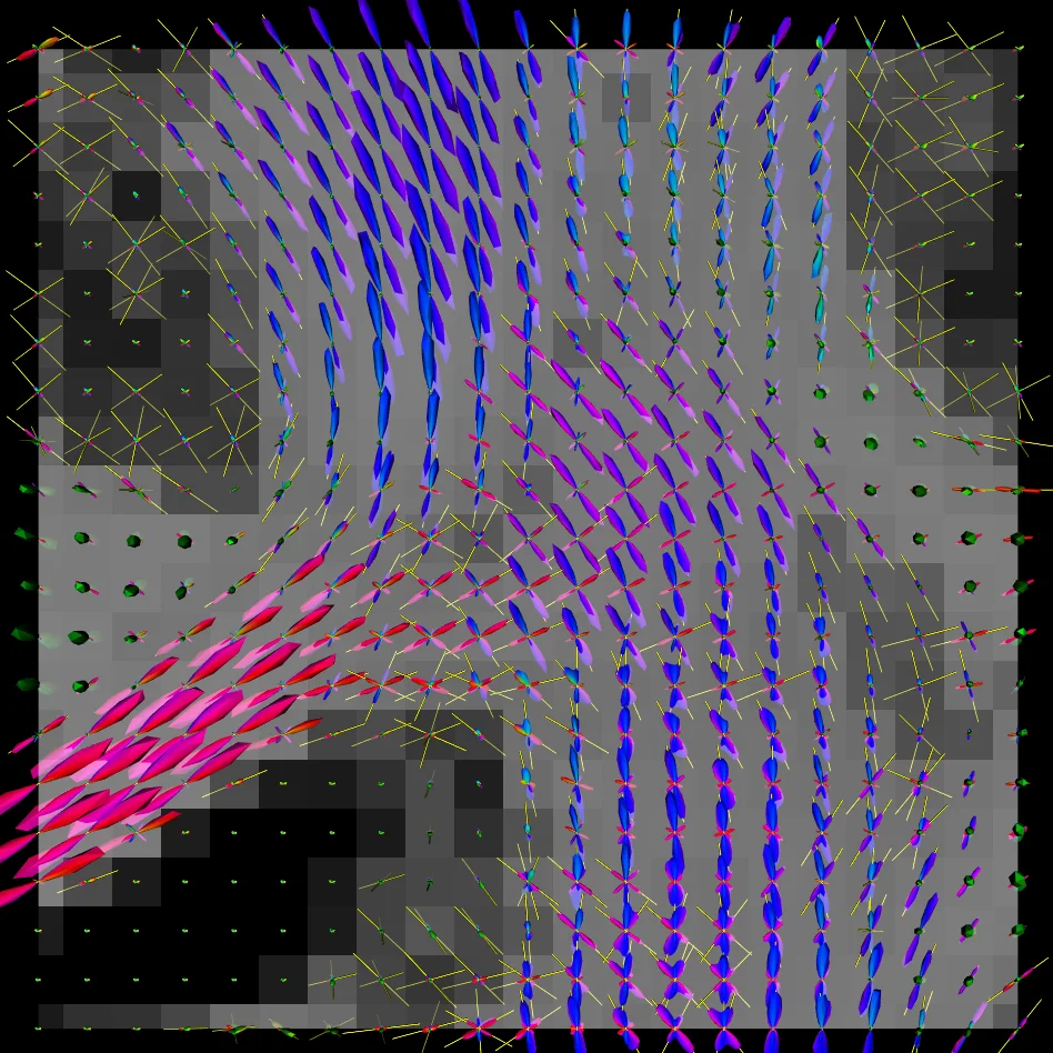 HAT-P-13b,c: a transiting hot Jupiter with a massive outer companion on   an eccentric orbit