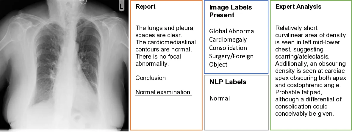Caveats in Generating Medical Imaging Labels from Radiology Reports
