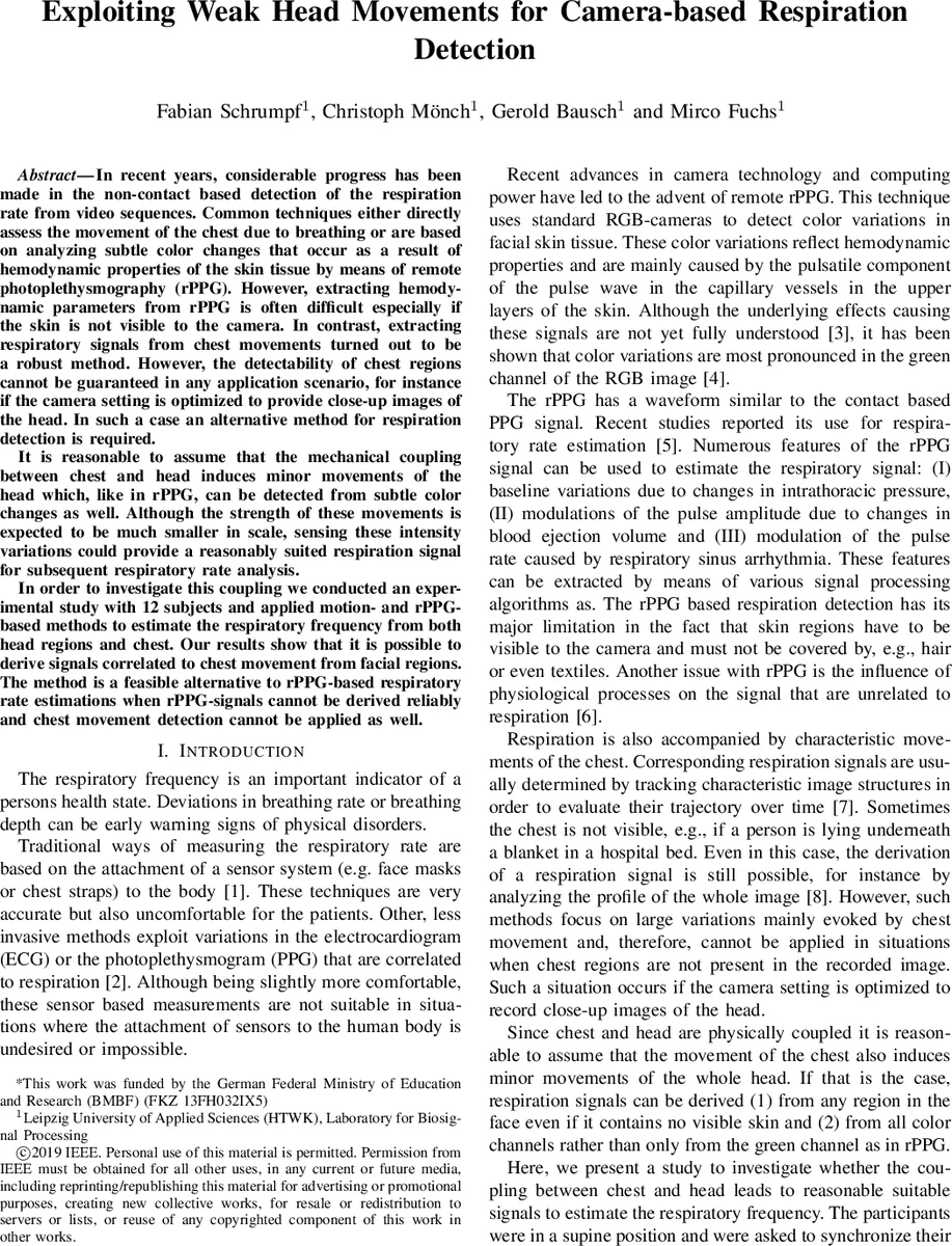 Interplay between microdynamics and macrorheology in vesicle suspensions
