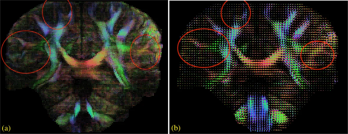 Smart, Deep Copy-Paste