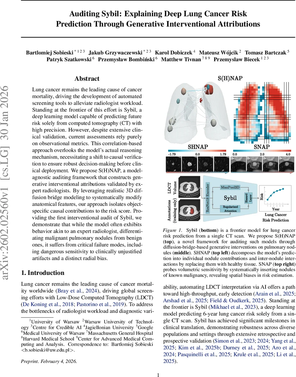 Auditing Sybil: Explaining Deep Lung Cancer Risk Prediction Through Generative Interventional Attributions