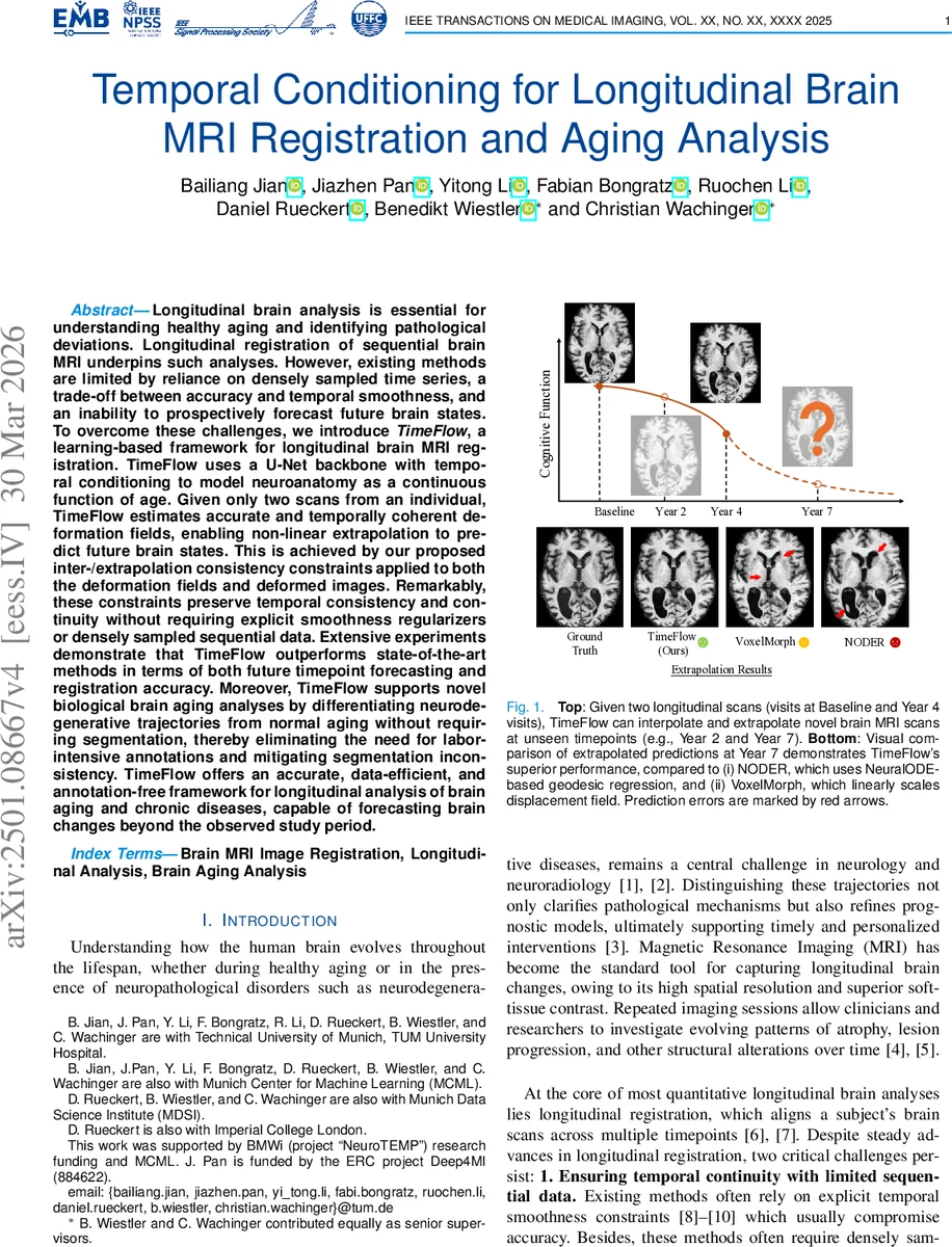 TimeFlow: Temporal Conditioning for Longitudinal Brain MRI Registration and Aging Analysis