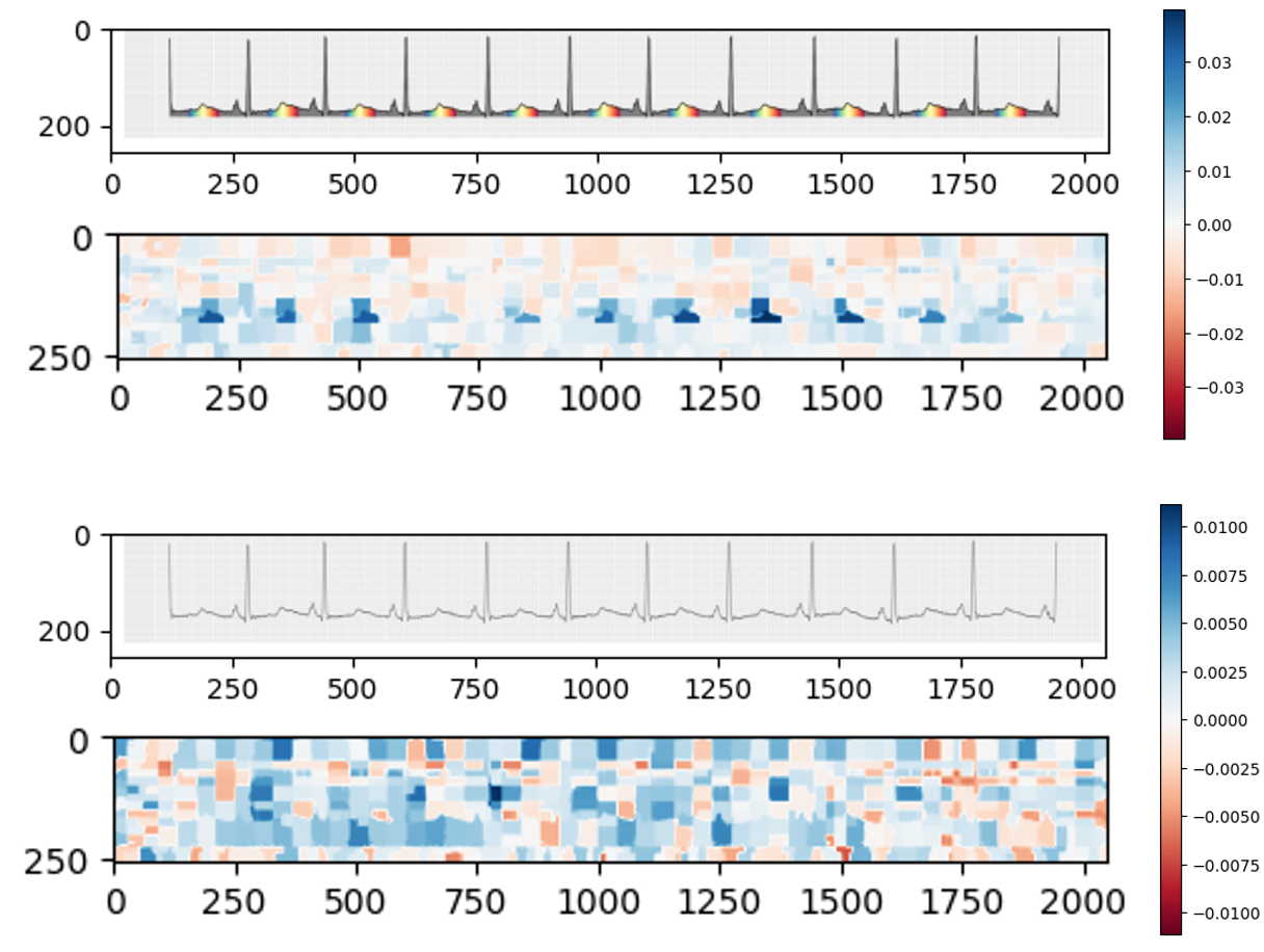 Human-like visual computing advances explainability and few-shot learning in deep neural networks for complex physiological data