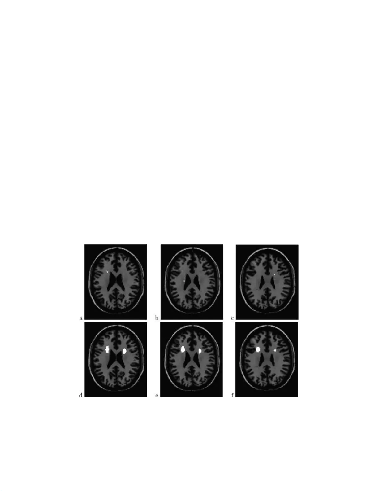 False discovery rate analysis of brain diffusion direction maps