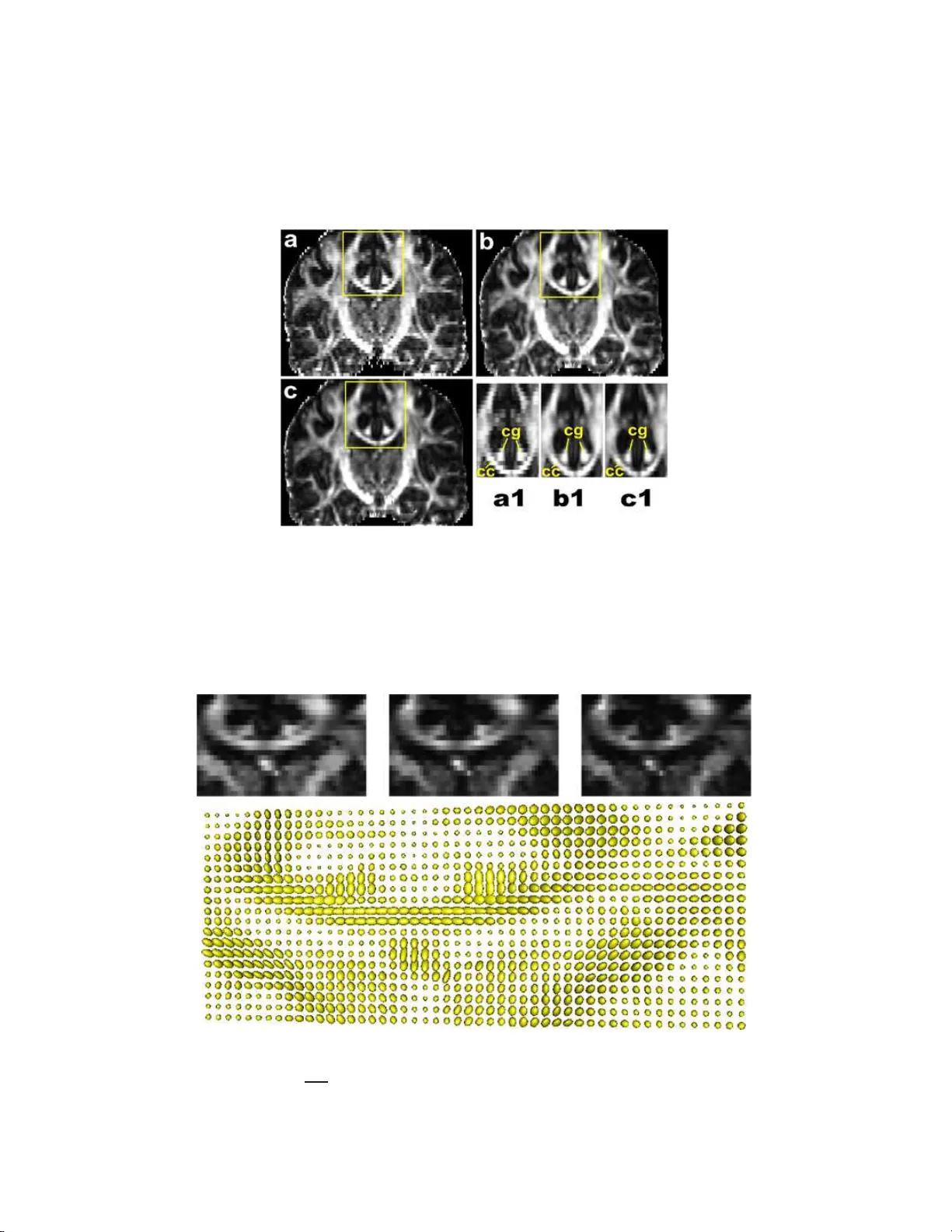 Non-Euclidean statistics for covariance matrices, with applications to   diffusion tensor imaging