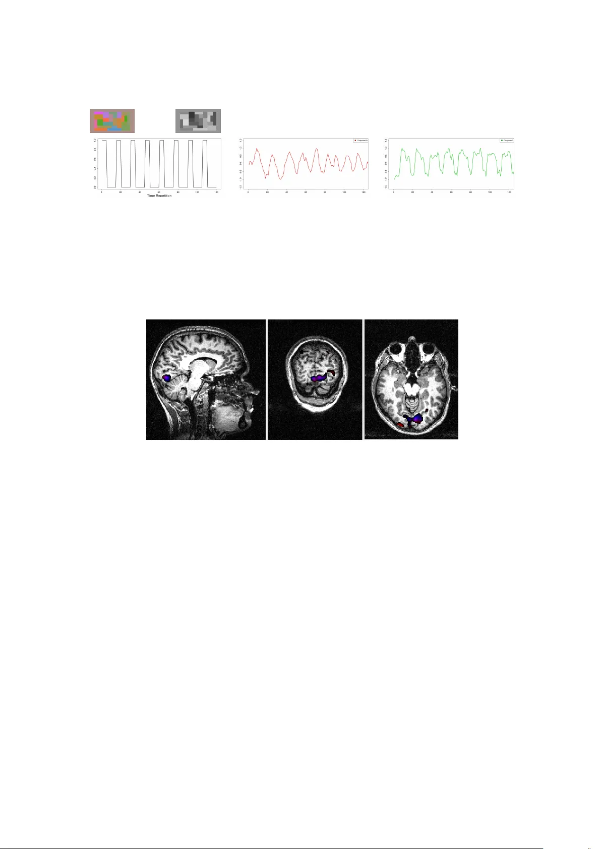 Temporal and Spatial Independent Component Analysis for fMRI data sets   embedded in a R package