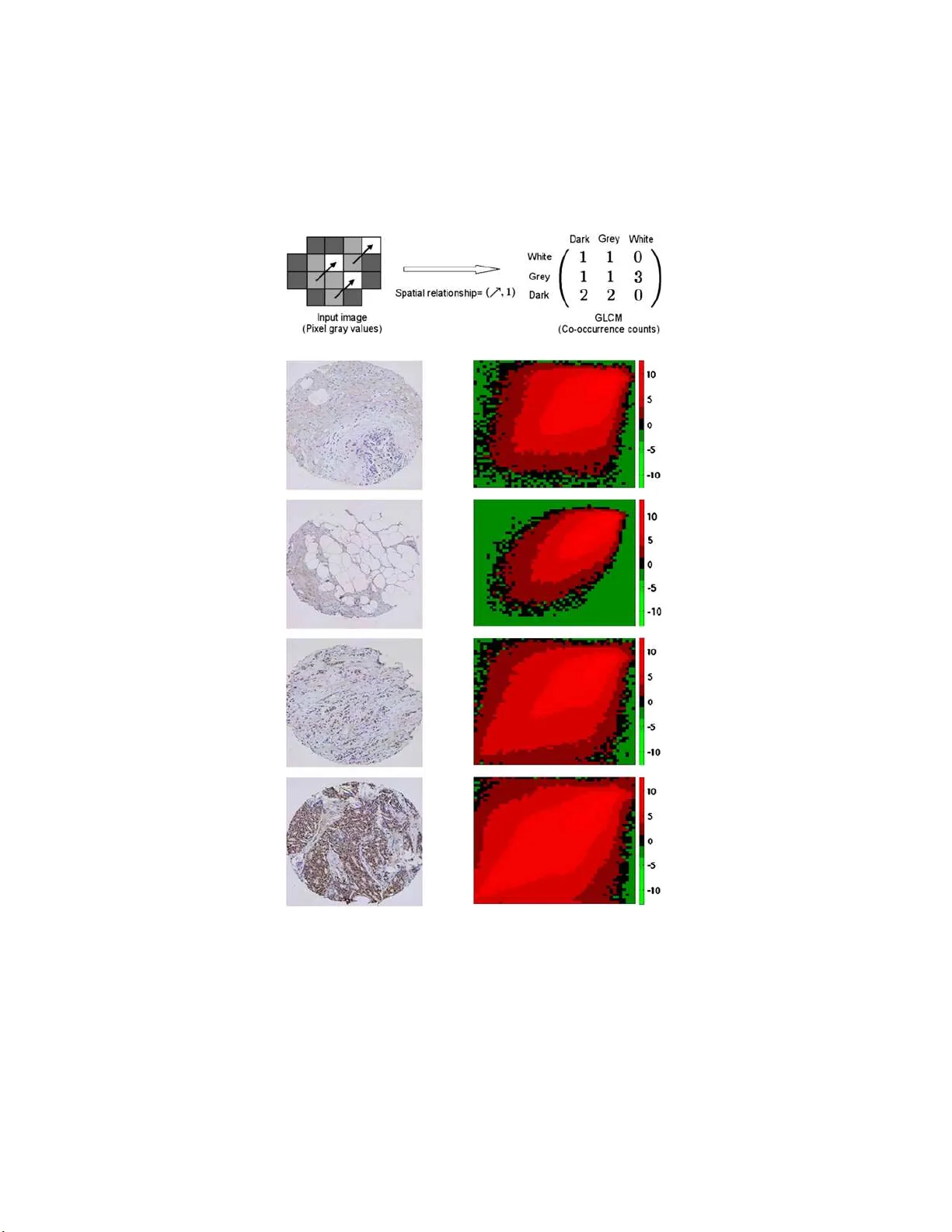 Statistical methods for tissue array images - algorithmic scoring and   co-training