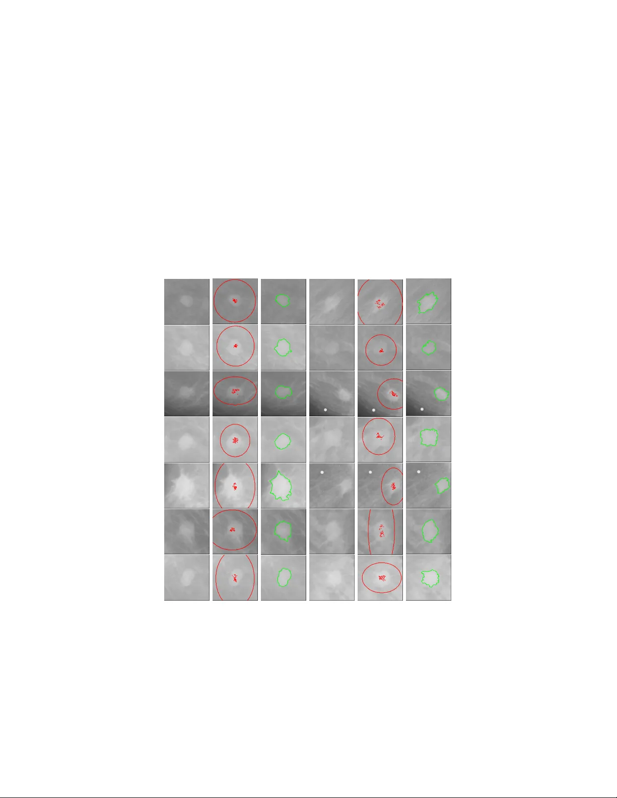 A semi-supervised fuzzy GrowCut algorithm to segment and classify   regions of interest of mammographic images