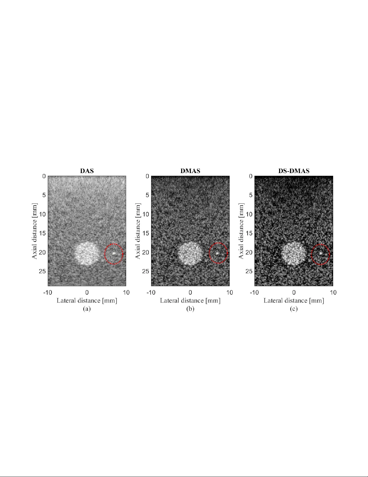 Double Stage Delay Multiply and Sum Beamforming Algorithm Applied to   Ultrasound Medical Imaging