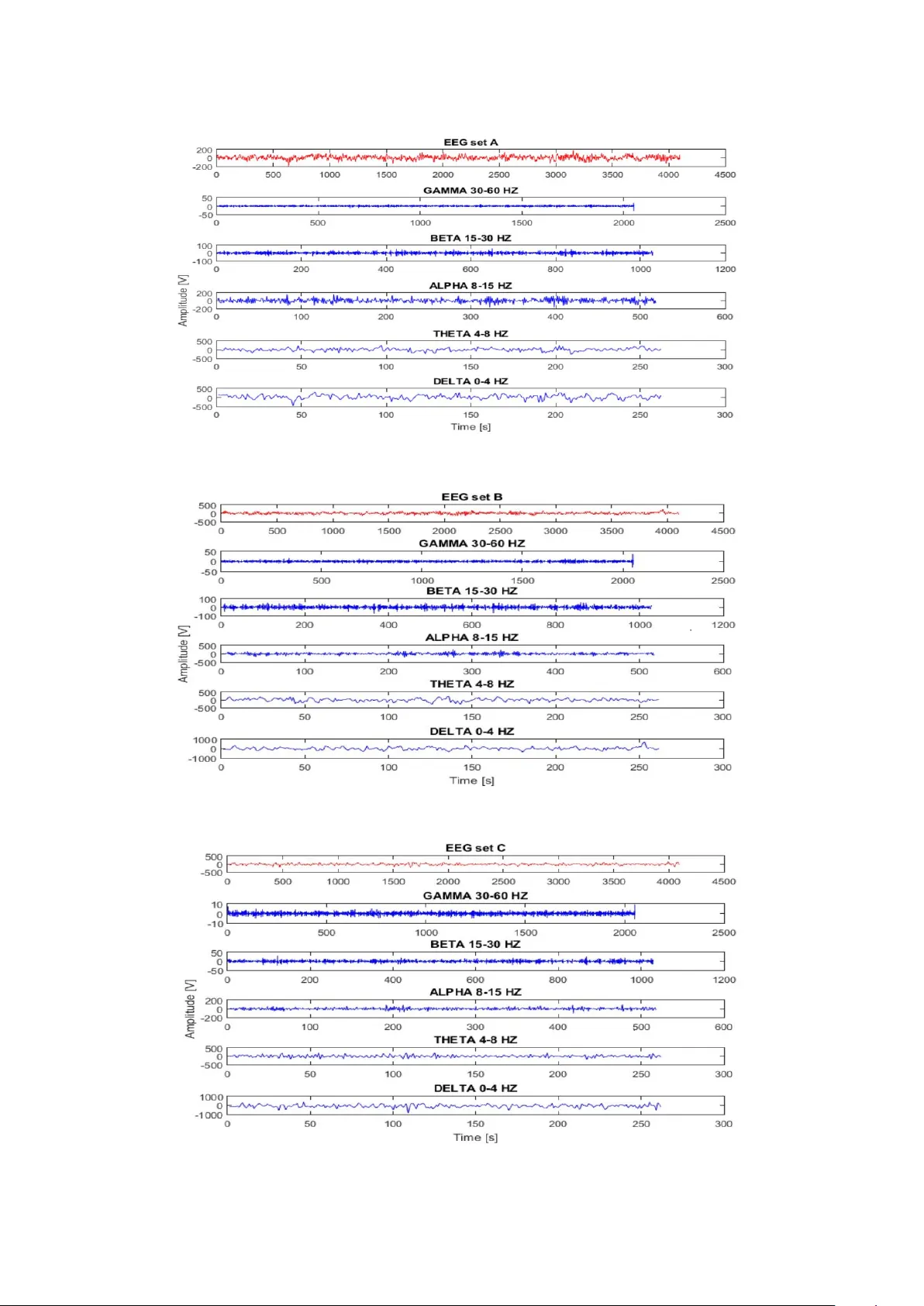 A hybrid automated detection of epileptic seizures in EEG based on   wavelet and machine learning techniques