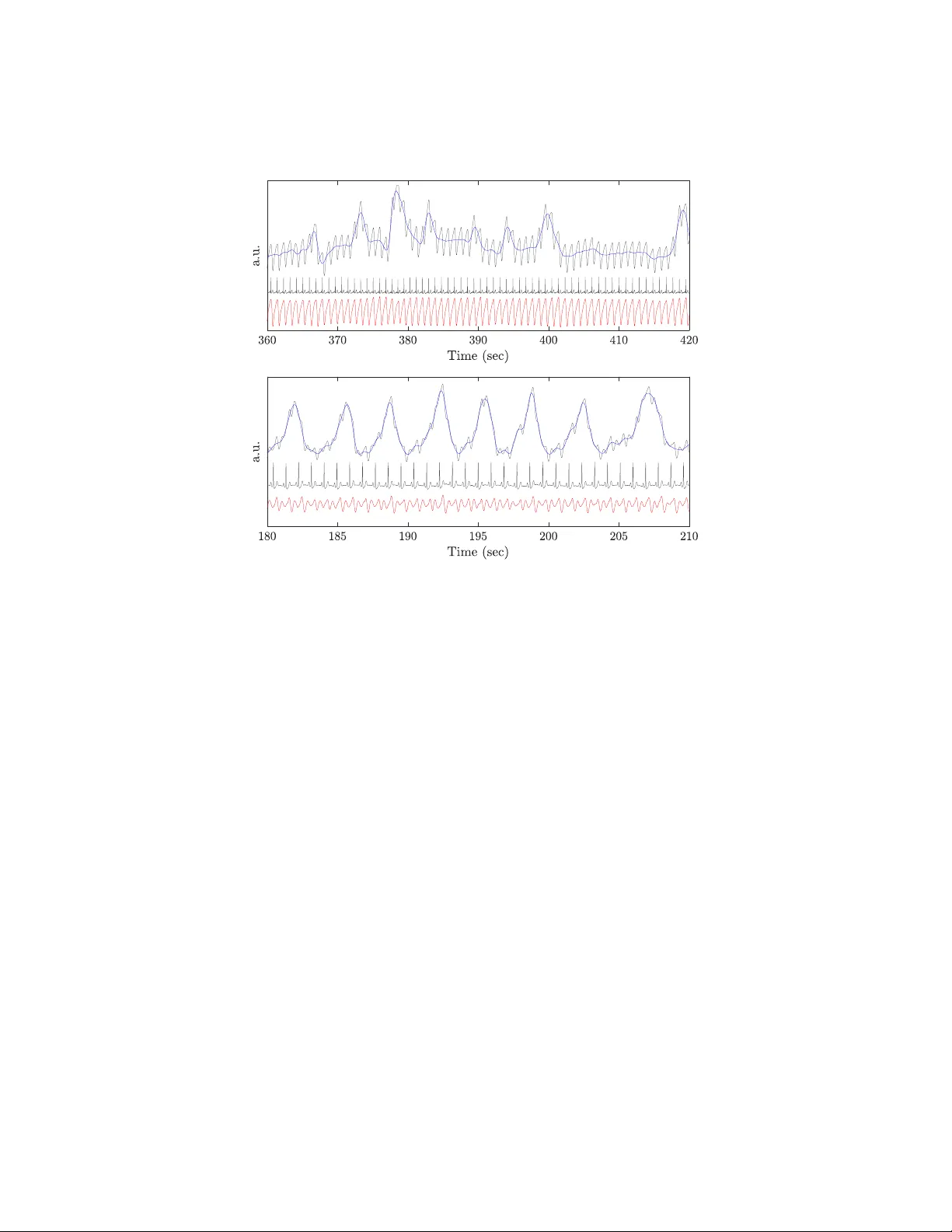 Recycling cardiogenic artifacts in impedance pneumography