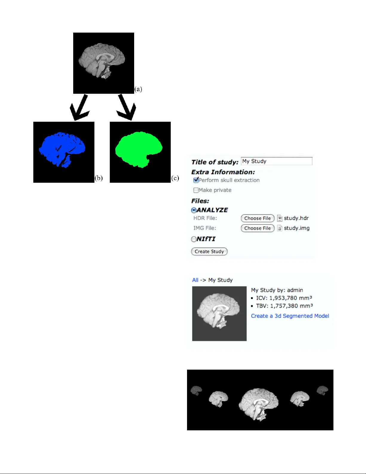 Web Based Brain Volume Calculation for Magnetic Resonance Images
