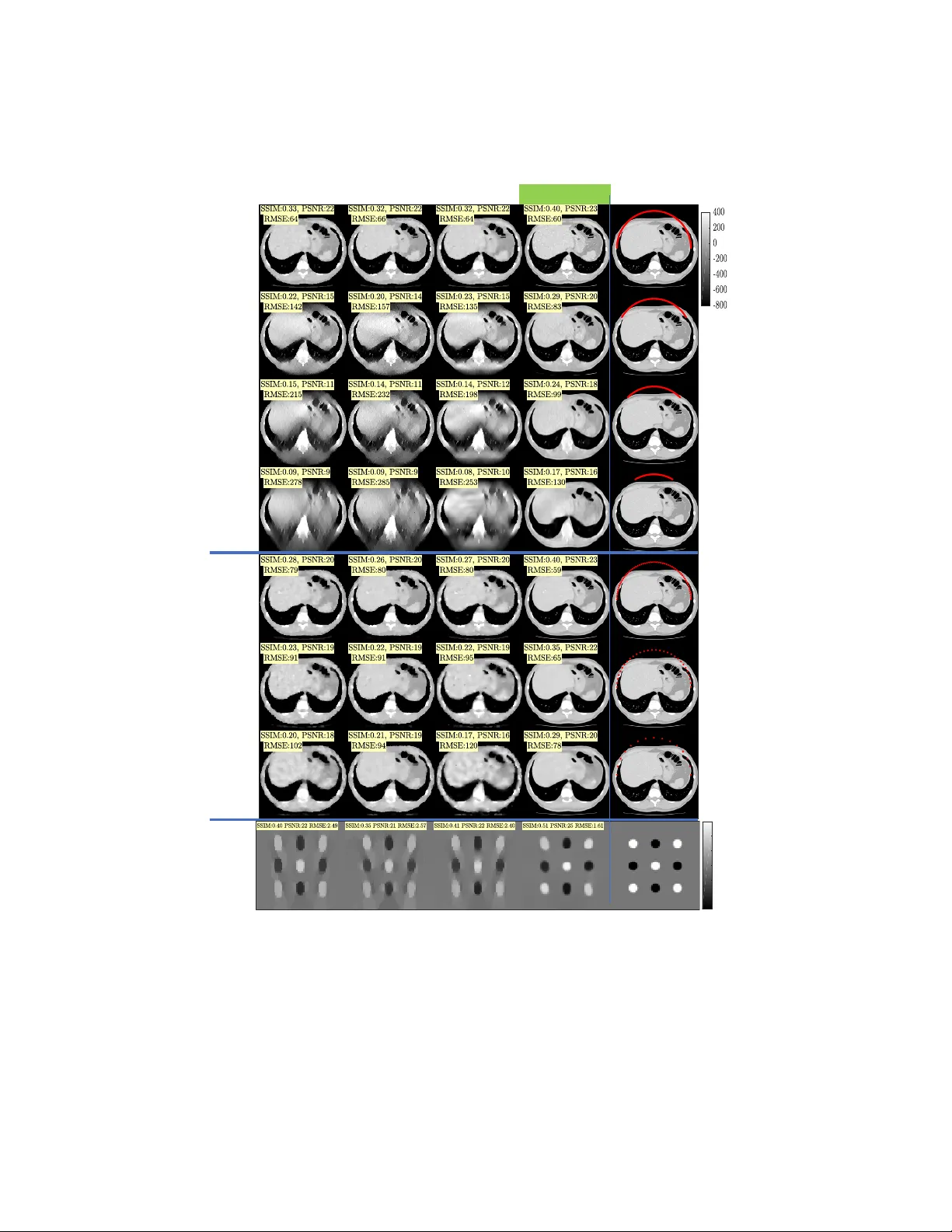 Deep Variational Networks with Exponential Weighting for Learning   Computed Tomography