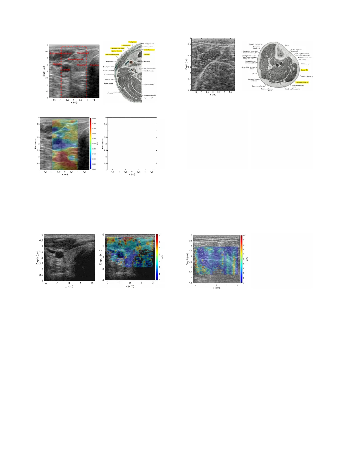 A Deep Learning Framework for Single-Sided Sound Speed Inversion in   Medical Ultrasound