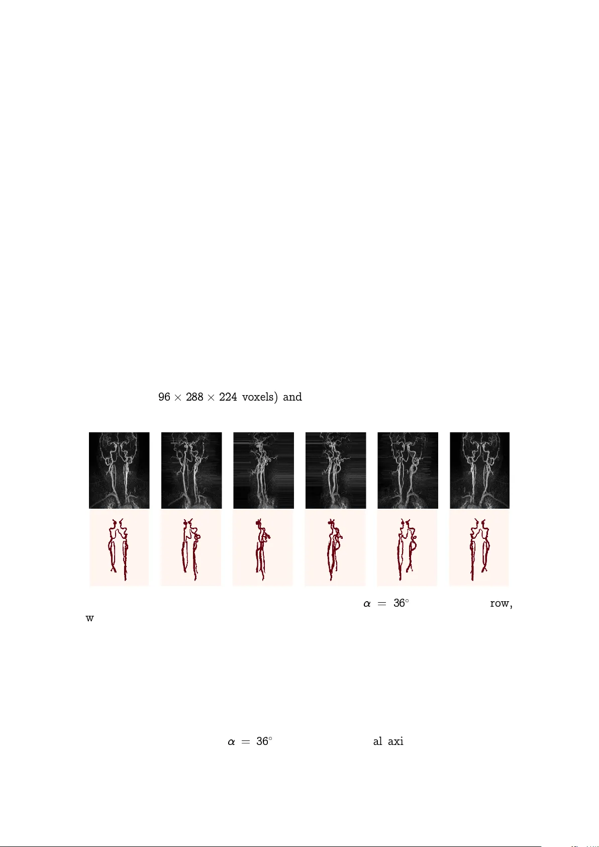 Projection-Based 2.5D U-net Architecture for Fast Volumetric   Segmentation