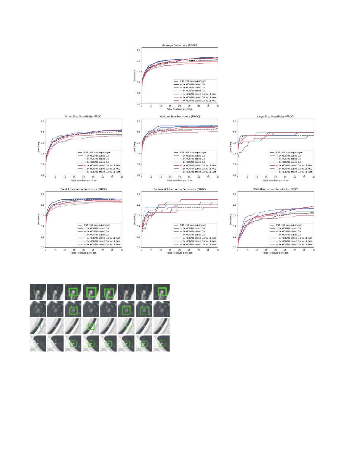 Synthesizing Diverse Lung Nodules Wherever Massively: 3D   Multi-Conditional GAN-based CT Image Augmentation for Object Detection