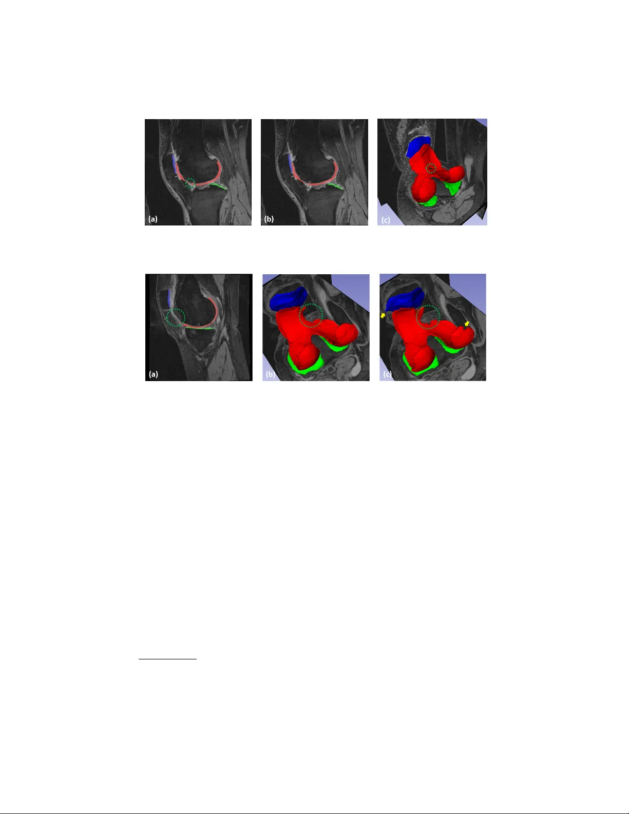 Collaborative Multi-agent Learning for MR Knee Articular Cartilage   Segmentation