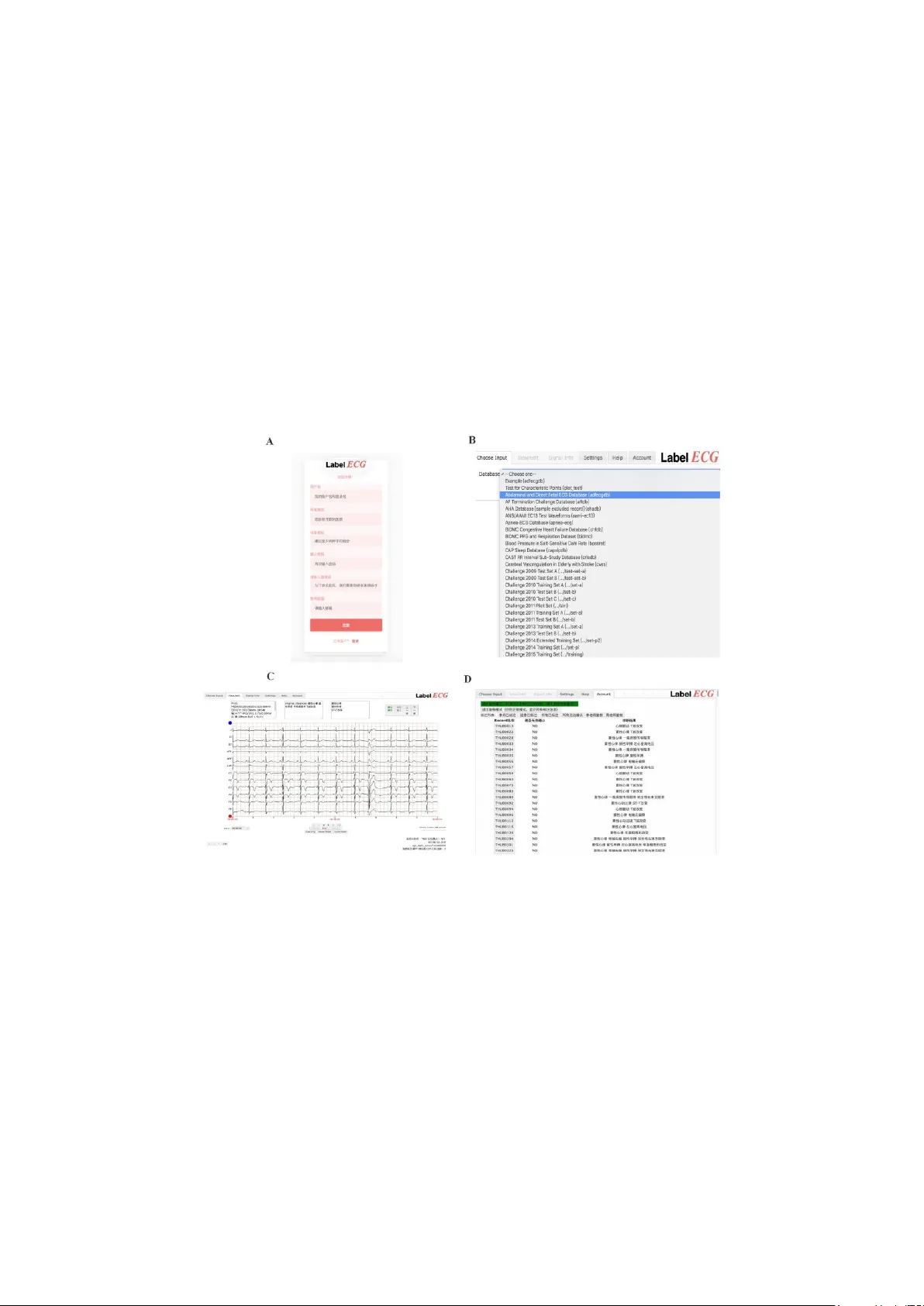 LabelECG: A Web-based Tool for Distributed Electrocardiogram Annotation