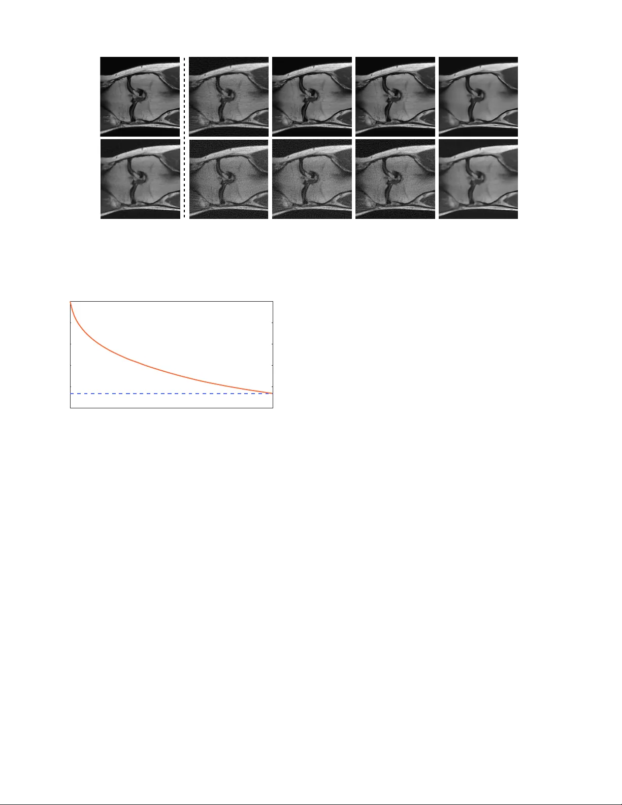 Block Coordinate Regularization by Denoising