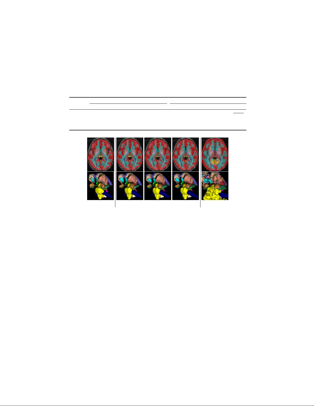 SegNAS3D: Network Architecture Search with Derivative-Free Global   Optimization for 3D Image Segmentation