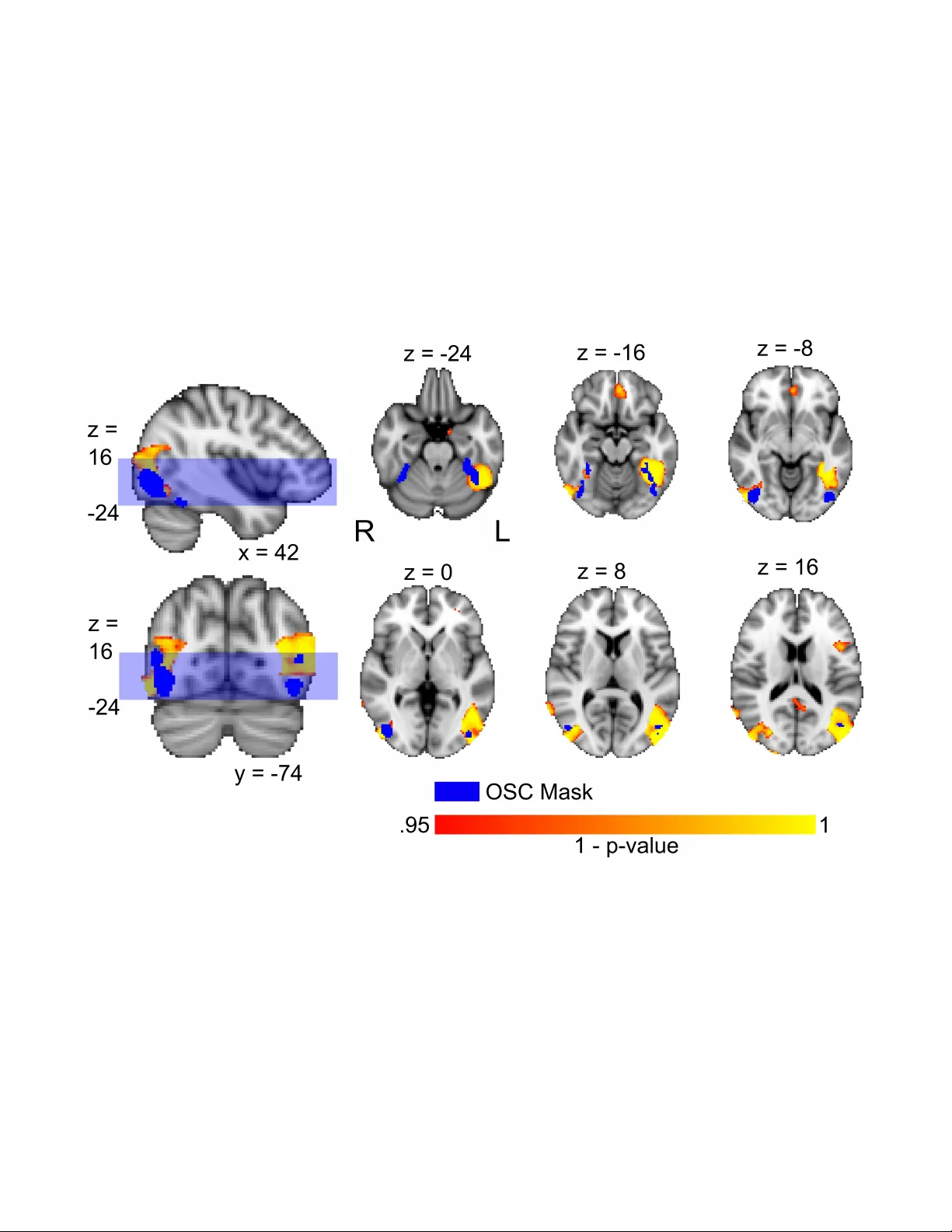 A Test for Shared Patterns in Cross-modal Brain Activation Analysis