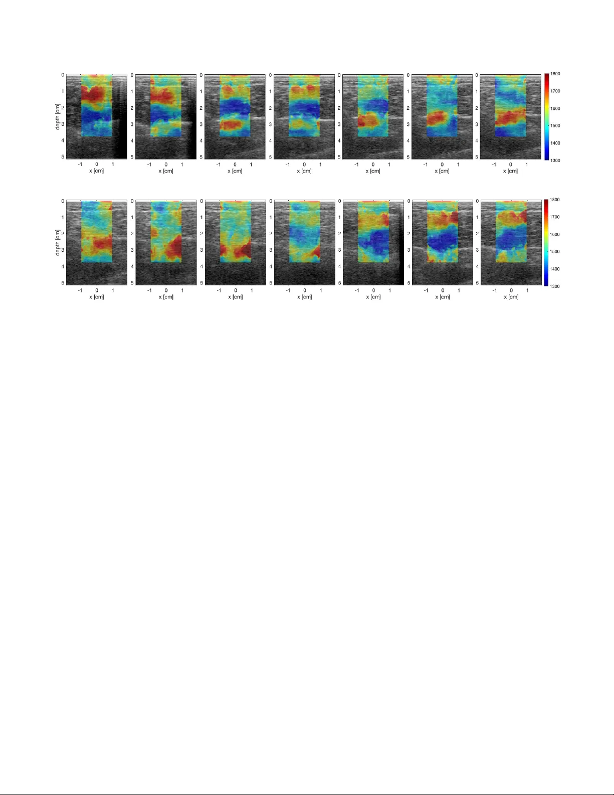 Detecting muscle activation using ultrasound speed of sound inversion   with deep learning