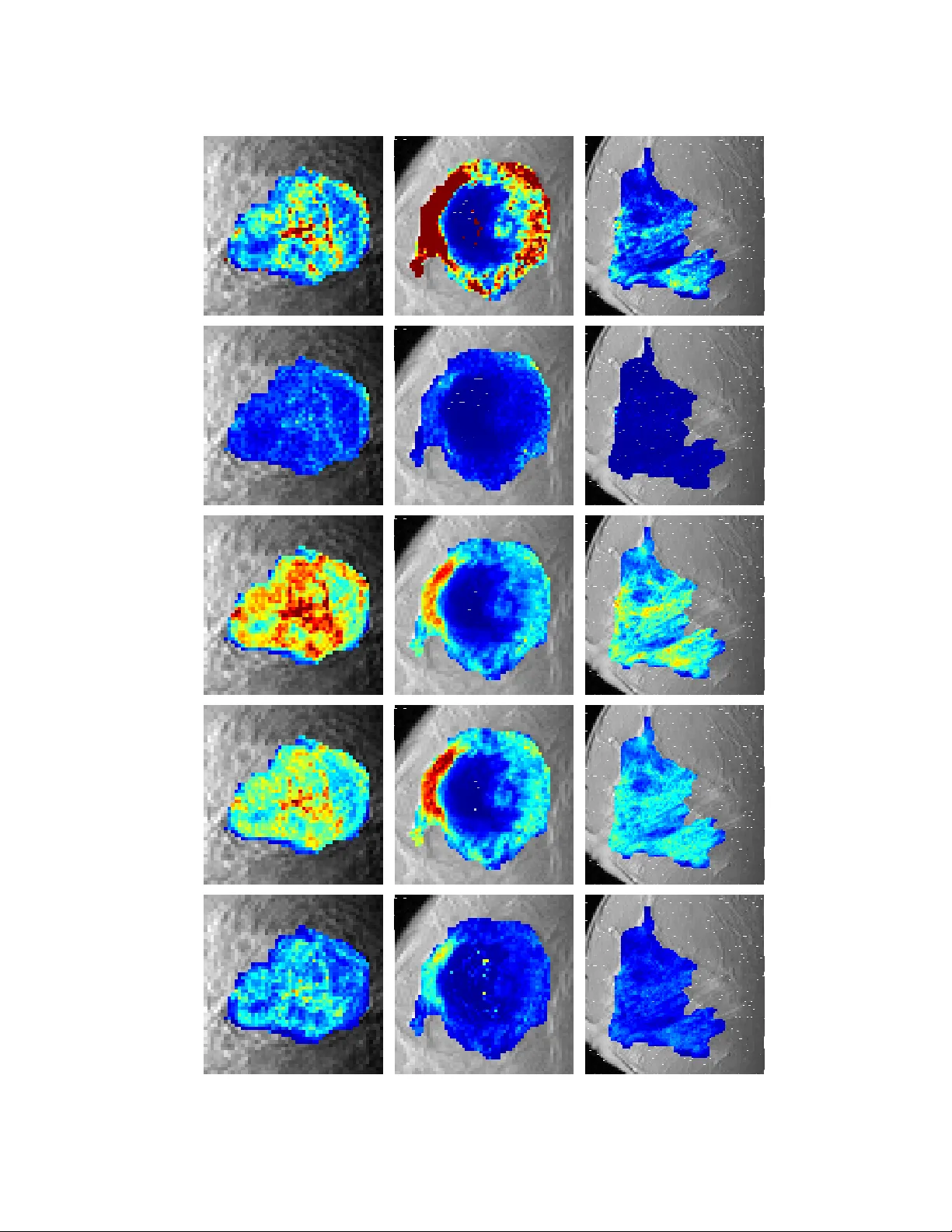 A Semi-parametric Technique for the Quantitative Analysis of Dynamic   Contrast-enhanced MR Images Based on Bayesian P-splines