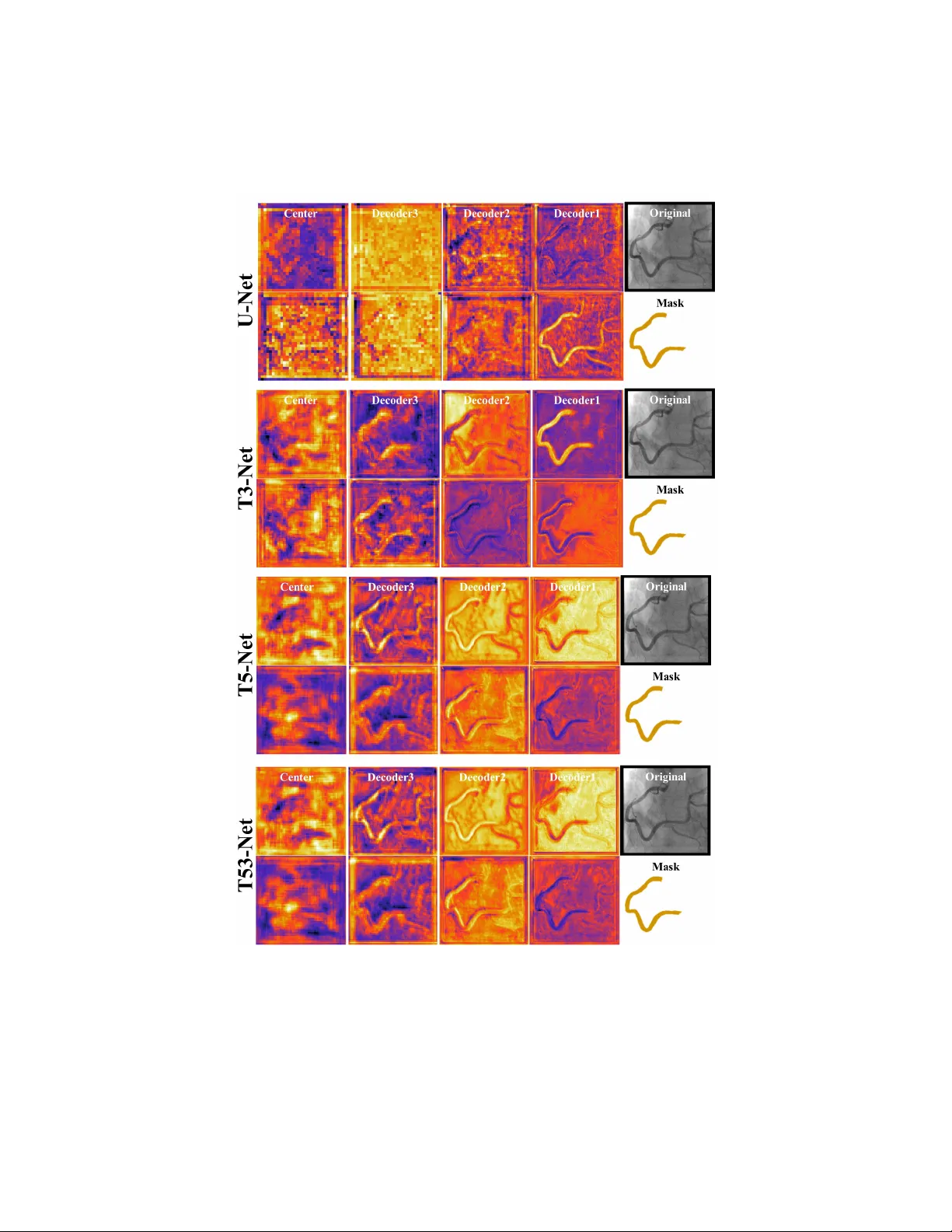 T-Net: Nested encoder-decoder architecture for the main vessel   segmentation in coronary angiography