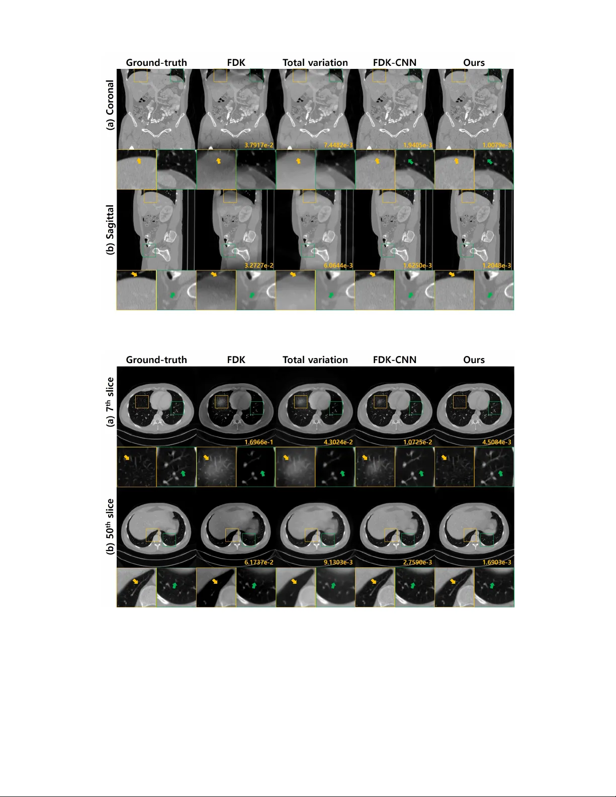 Differentiated Backprojection Domain Deep Learning for Conebeam Artifact   Removal