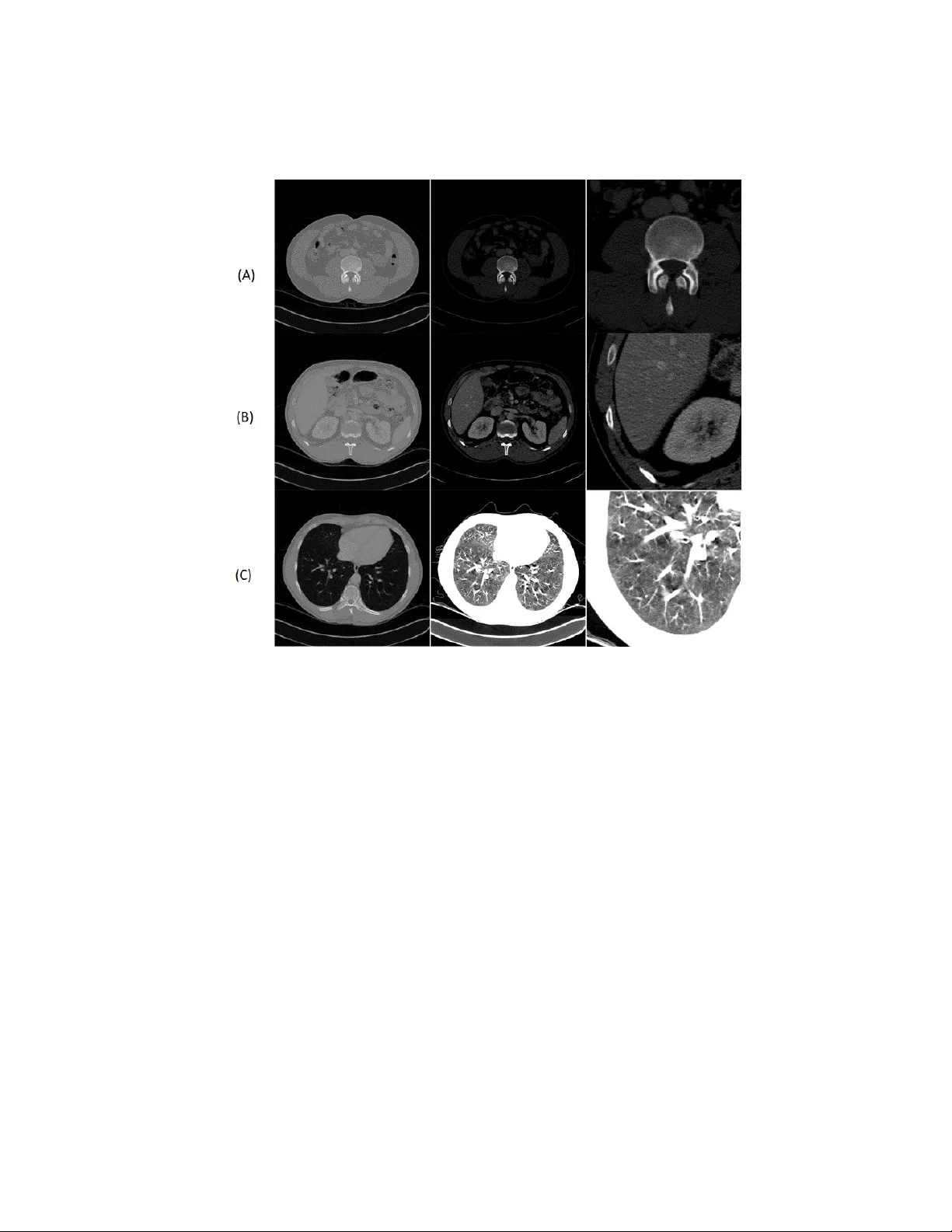 Domain specific cues improve robustness of deep learning based   segmentation of ct volumes