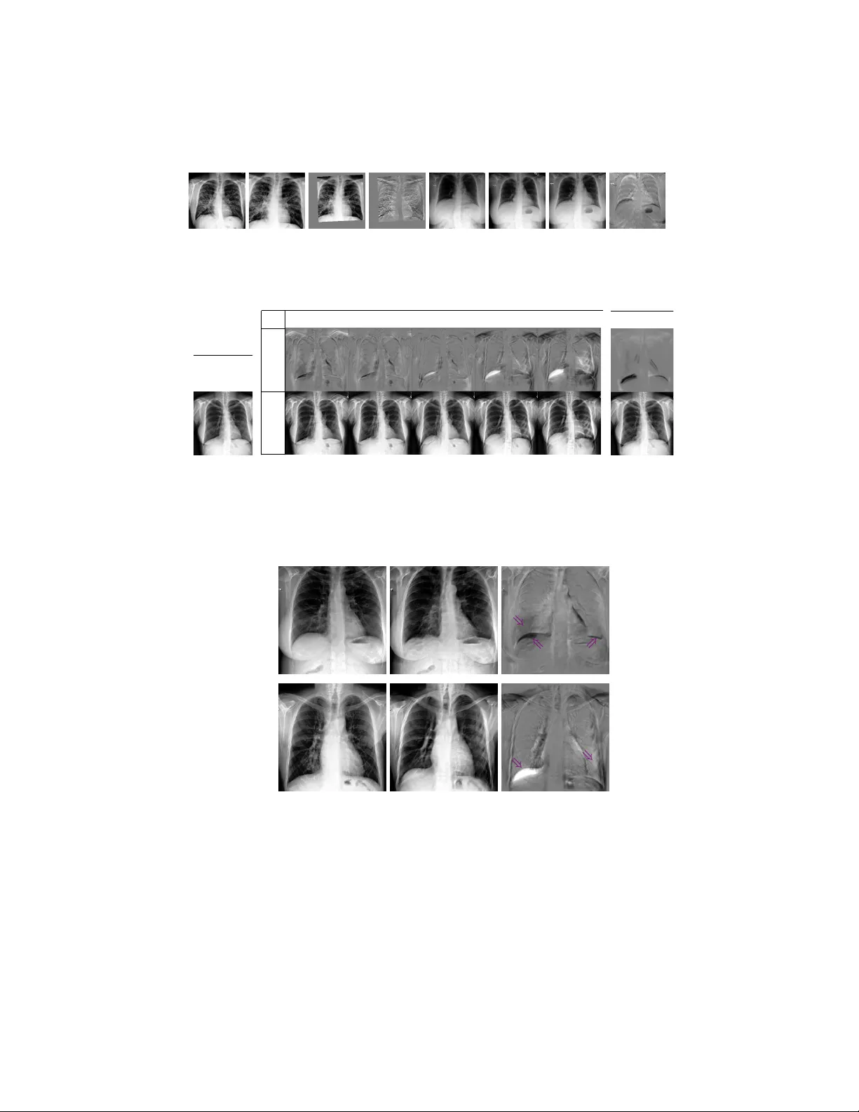 Adversarial regression training for visualizing the progression of   chronic obstructive pulmonary disease with chest x-rays
