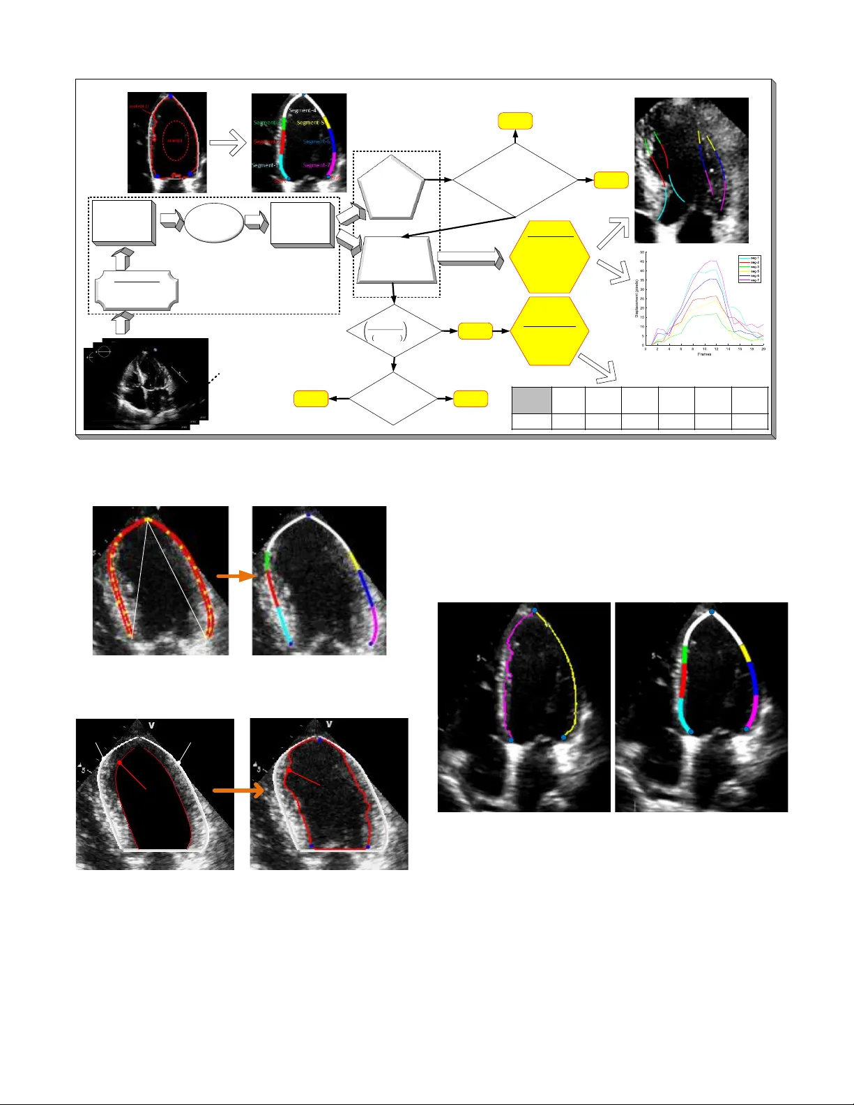 Left Ventricular Wall Motion Estimation by Active Polynomials for Acute Myocardial Infarction Detection