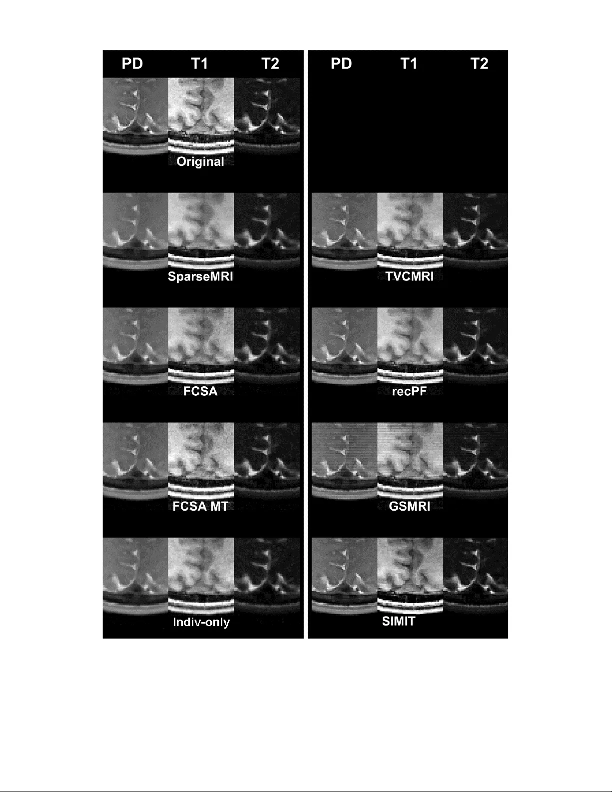 Simultaneous use of Individual and Joint Regularization Terms in   Compressive Sensing: Joint Reconstruction of Multi-Channel Multi-Contrast MRI   Acquisitions