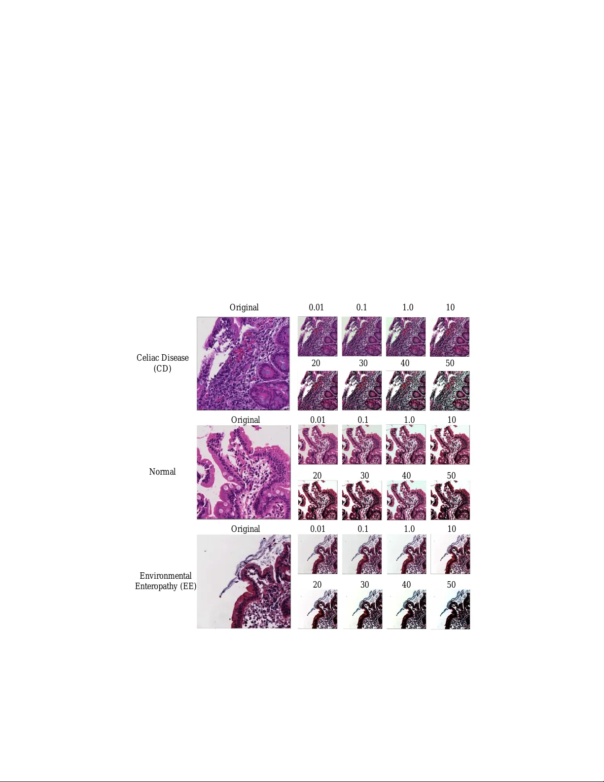 Diagnosis of Celiac Disease and Environmental Enteropathy on Biopsy   Images Using Color Balancing on Convolutional Neural Networks