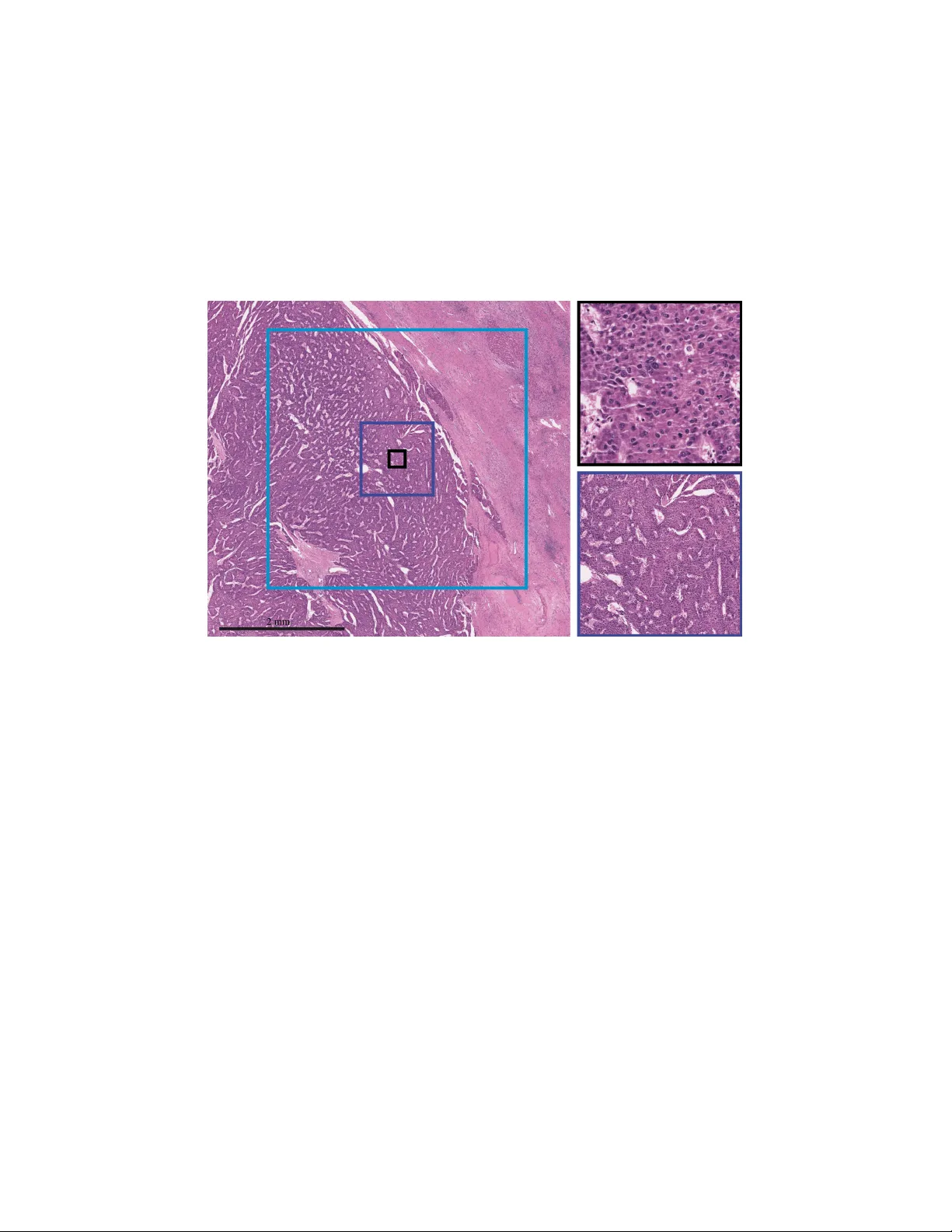 Multi-scale fully convolutional neural networks for histopathology image   segmentation: from nuclear aberrations to the global tissue architecture