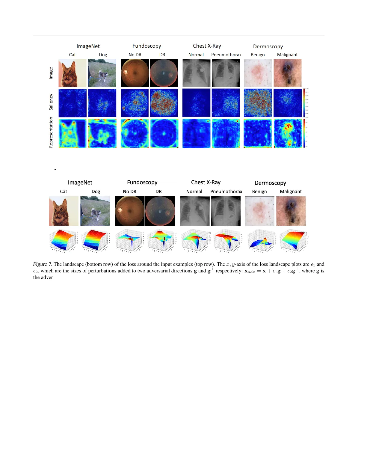 Understanding Adversarial Attacks on Deep Learning Based Medical Image   Analysis Systems