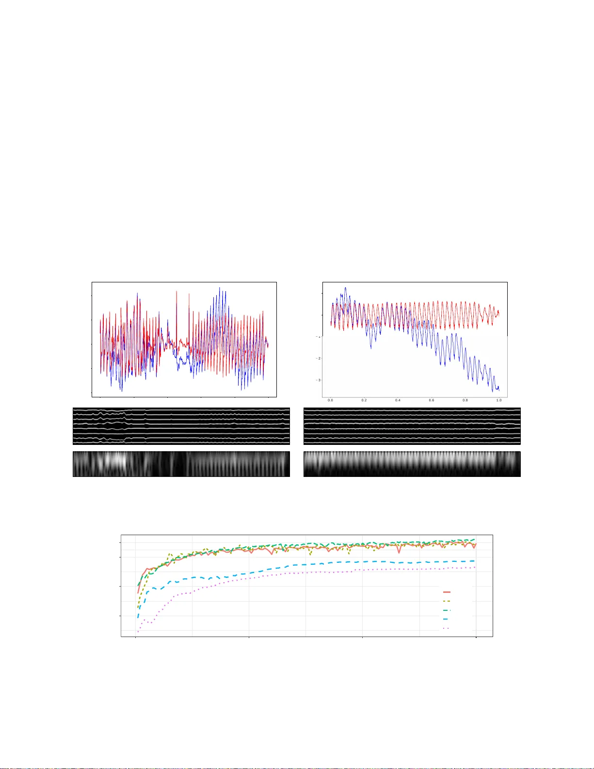 Method to Annotate Arrhythmias by Deep Network