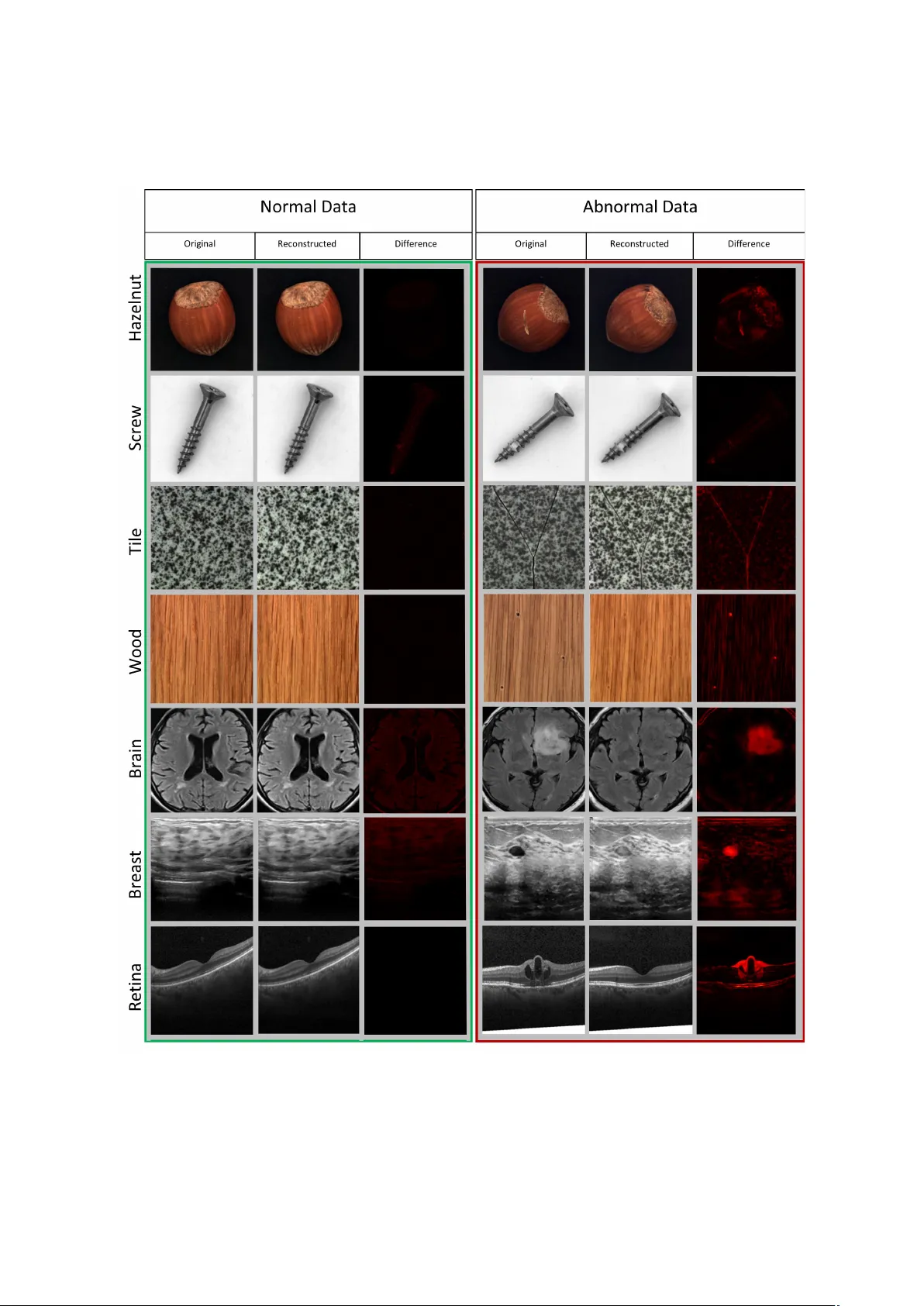 Industrial and Medical Anomaly Detection Through Cycle-Consistent Adversarial Networks