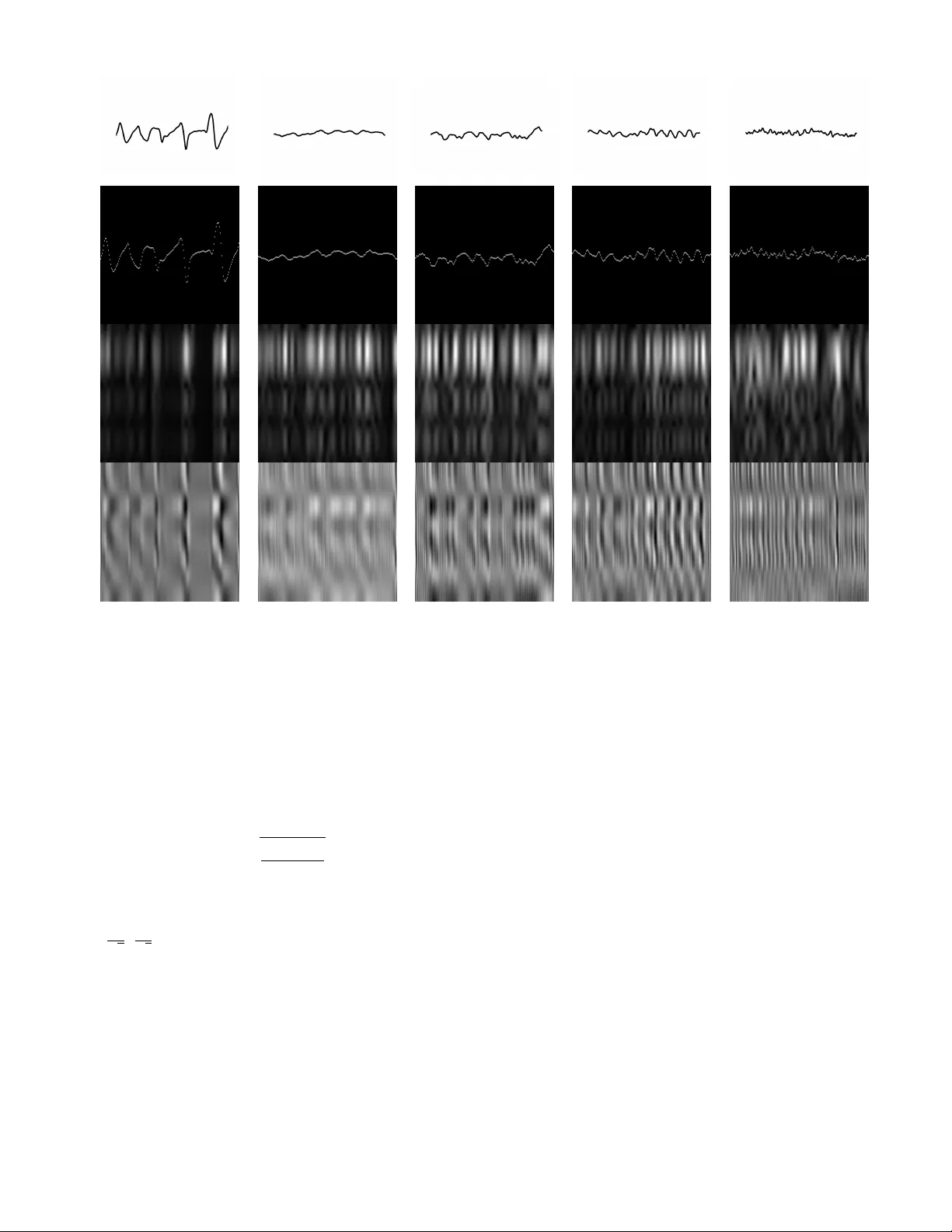 Signal2Image Modules in Deep Neural Networks for EEG Classification