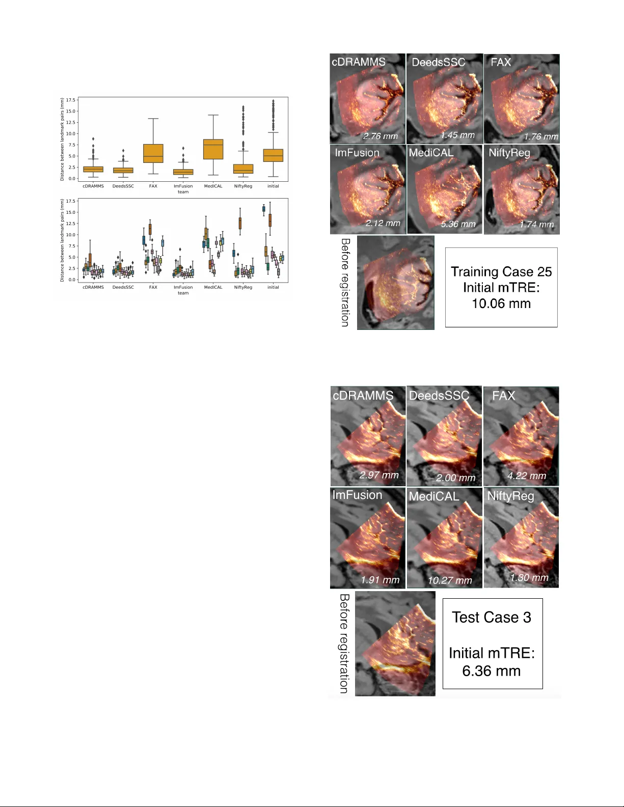 Evaluation of MRI to ultrasound registration methods for brain shift   correction: The CuRIOUS2018 Challenge