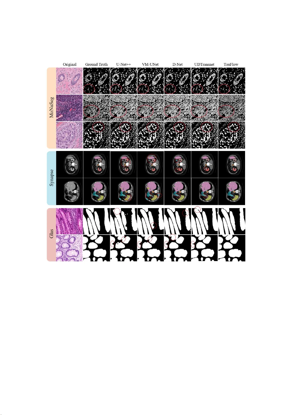 TauFlow: Dynamic Causal Constraint for Complexity-Adaptive Lightweight Segmentation