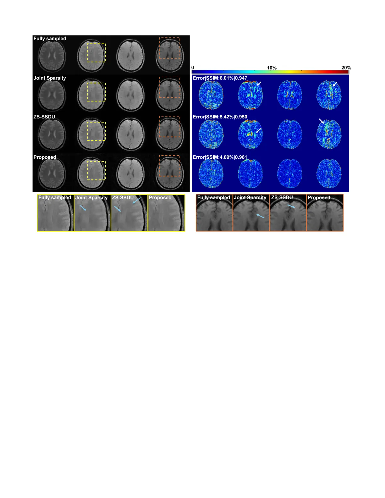 An Adaptive, Disentangled Representation for Multidimensional MRI Reconstruction