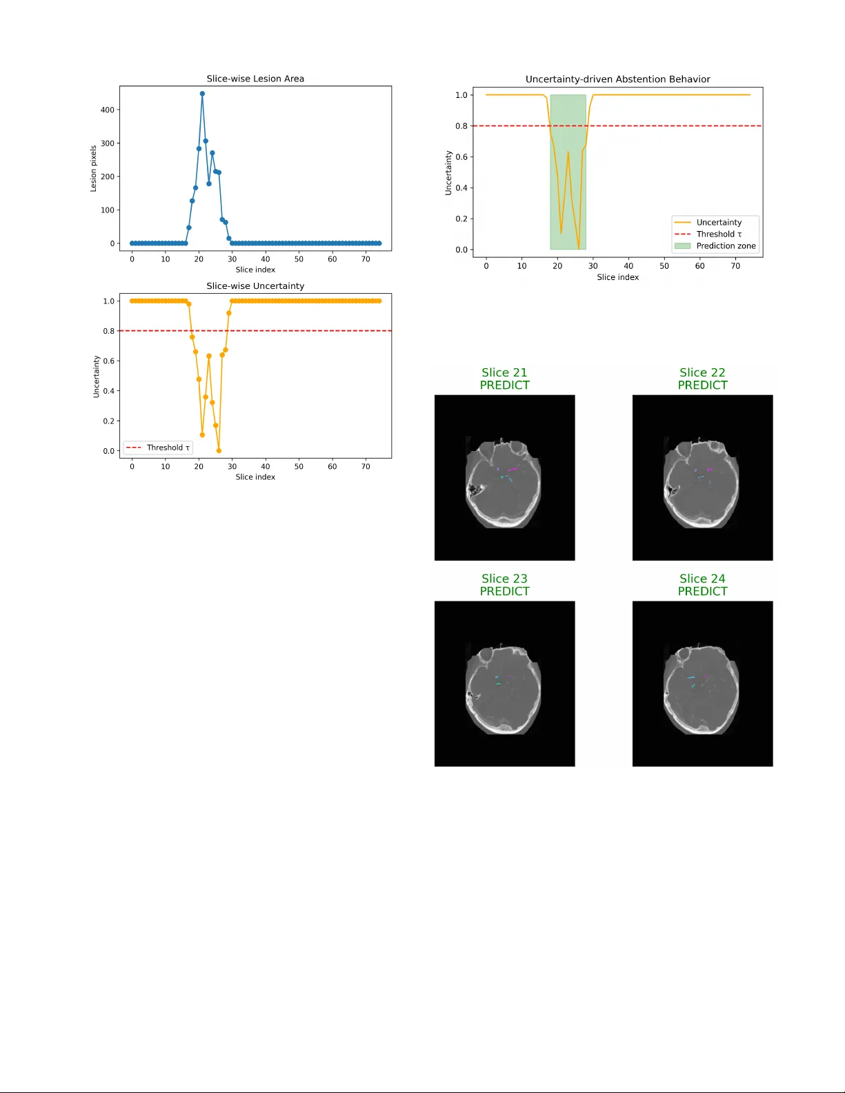 An Explainable Agentic AI Framework for Uncertainty-Aware and Abstention-Enabled Acute Ischemic Stroke Imaging Decisions