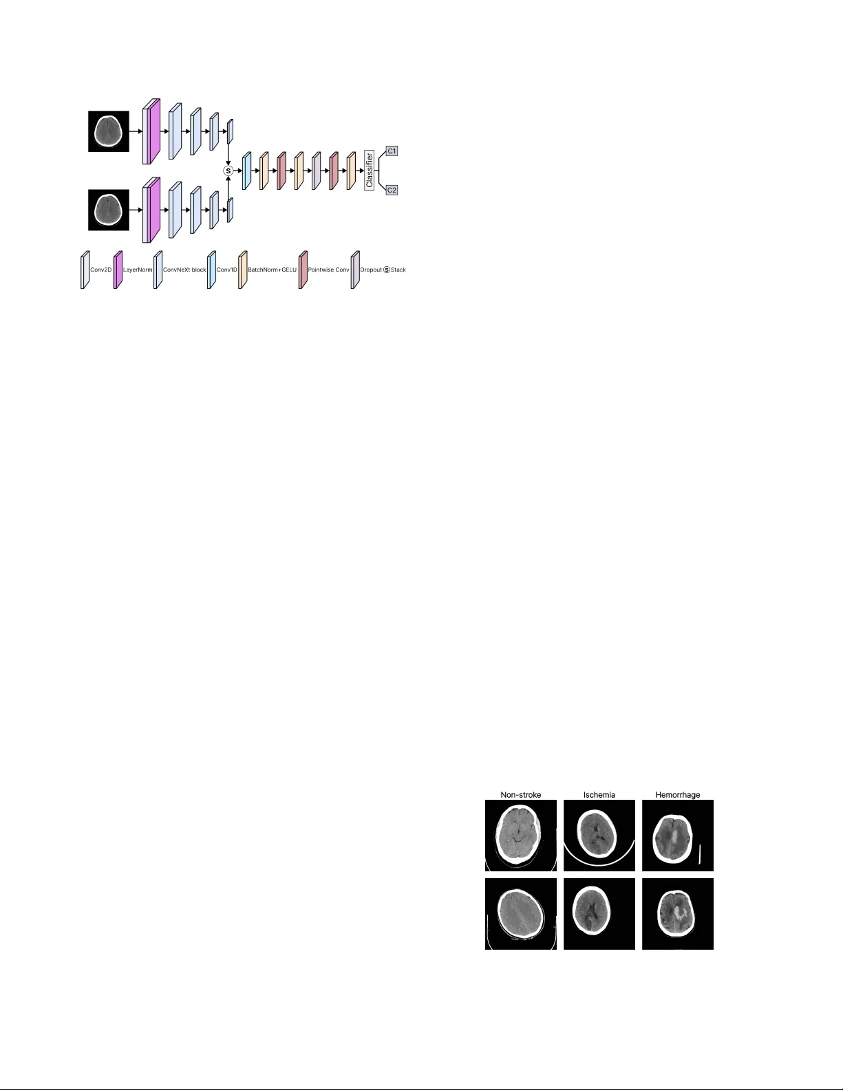 StrokeNeXt: A Siamese-encoder Approach for Brain Stroke Classification in Computed Tomography Imagery