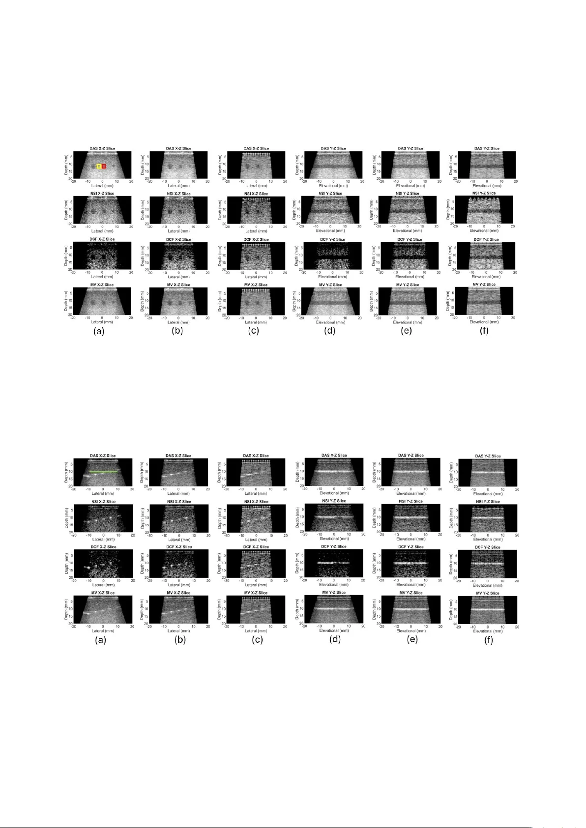 Large elements and advanced beamformers for increased field of view in 2-D ultrasound matrix arrays