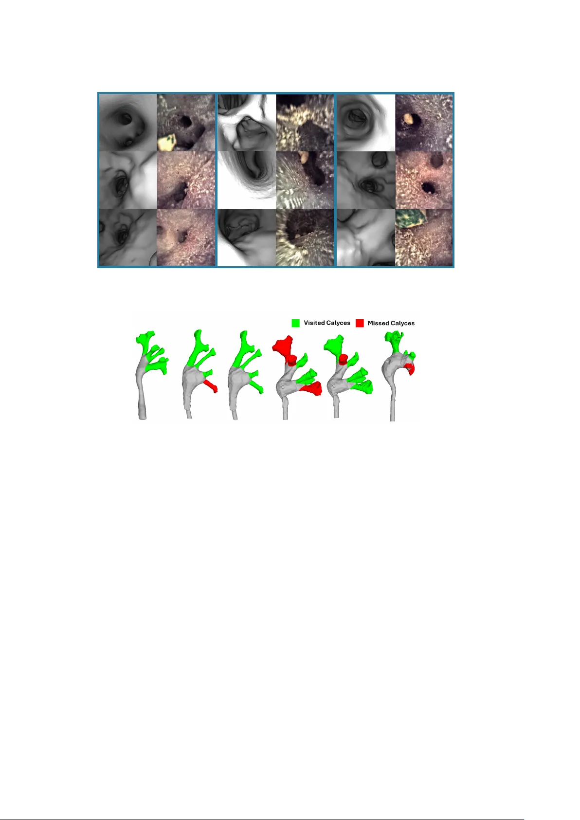 Automated Assessment of Kidney Ureteroscopy Exploration for Training