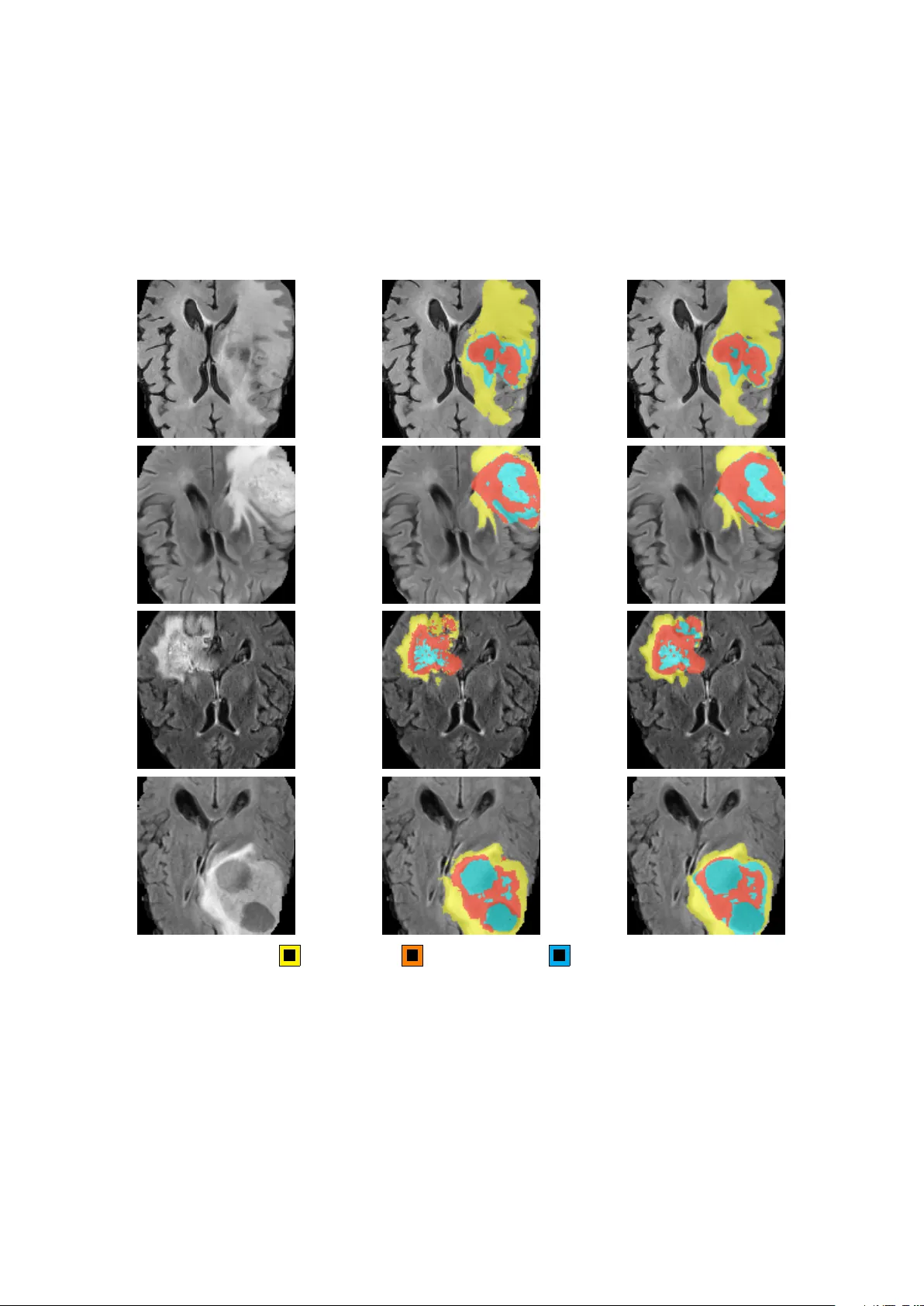 RefineFormer3D: Efficient 3D Medical Image Segmentation via Adaptive Multi-Scale Transformer with Cross Attention Fusion