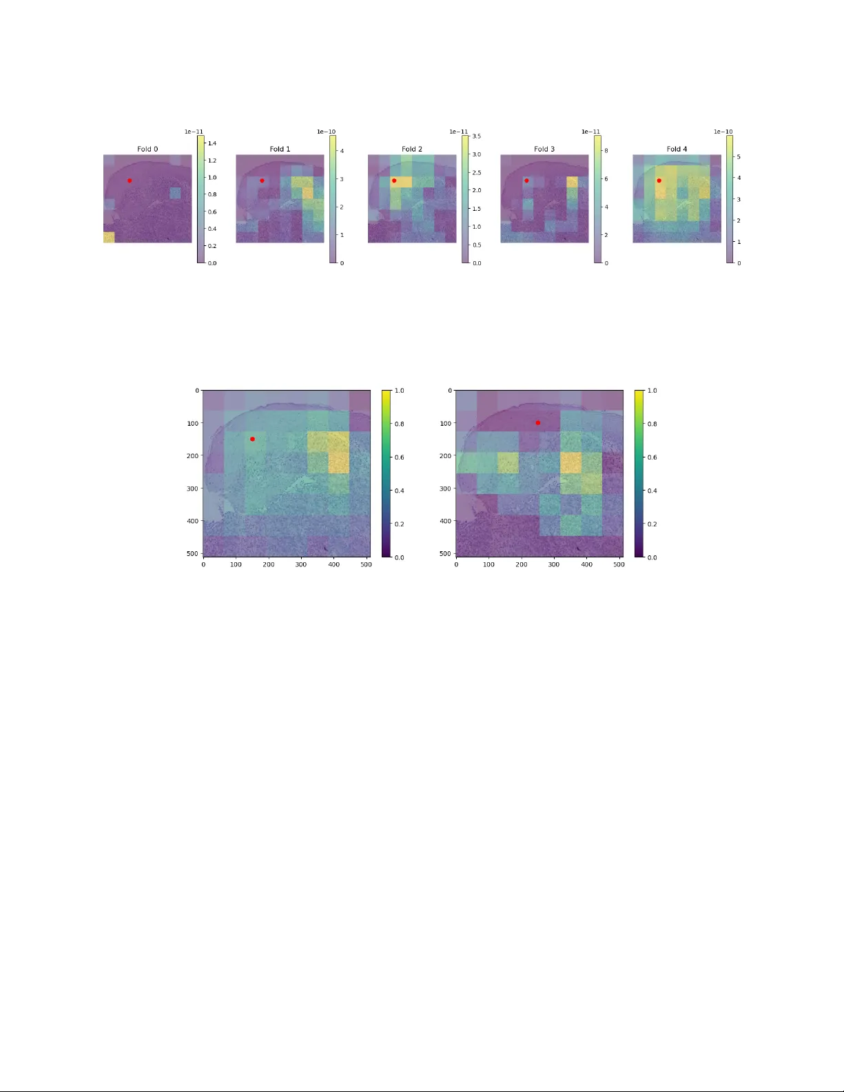 RamanSeg: Interpretability-driven Deep Learning on Raman Spectra for Cancer Diagnosis
