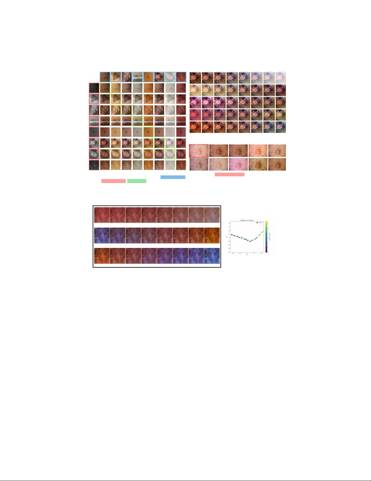 Automated Disentangling Analysis of Skin Colour for Lesion Images
