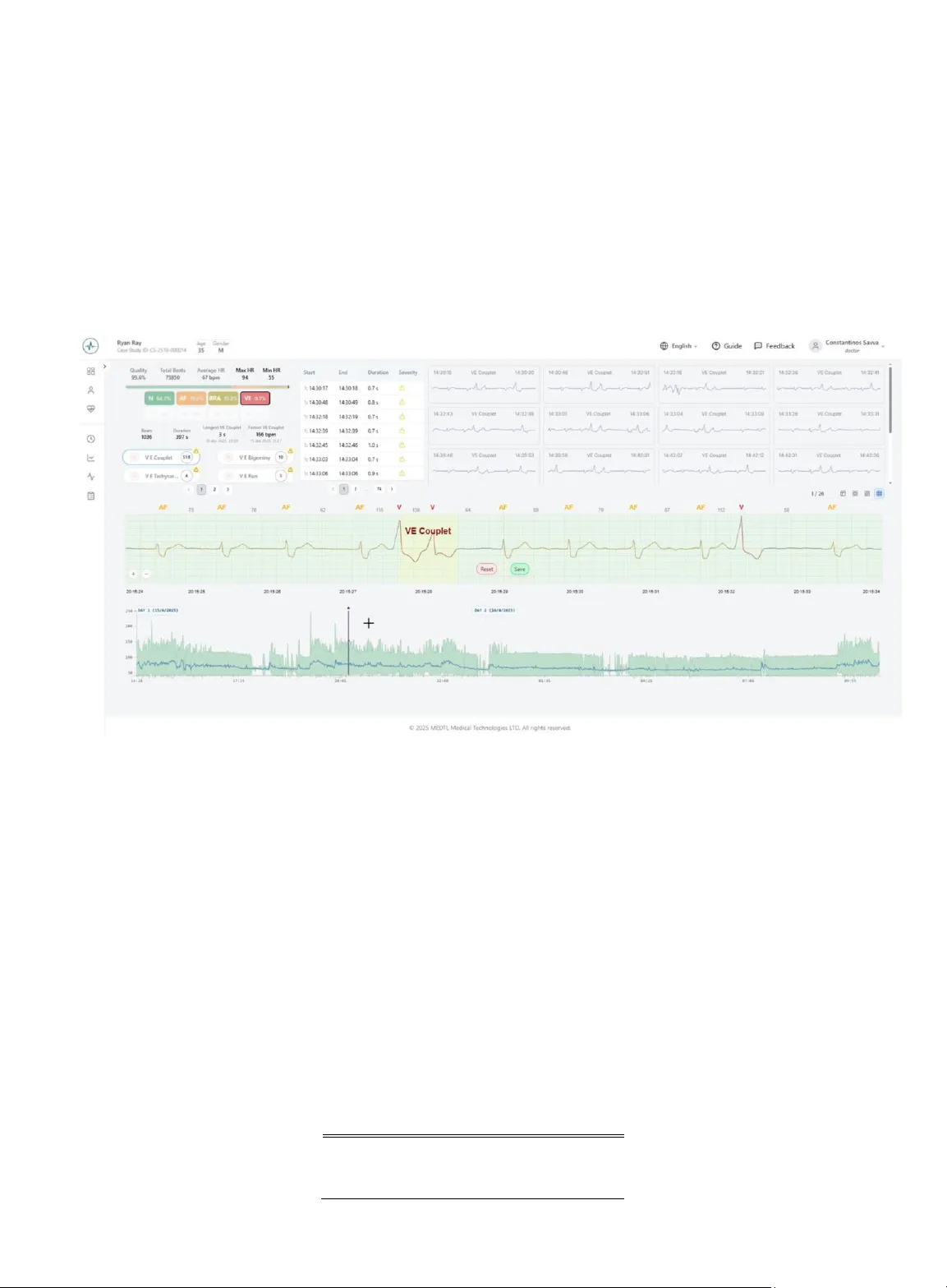 A Novel end-to-end Digital Health System Using Deep Learning-based ECG Analysis